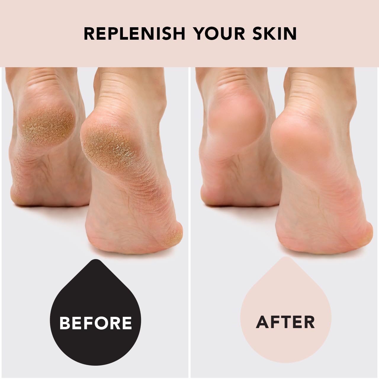 Kitsch Moisturizing Spa Socks - Gel Socks For Cracked Heel Repair  Heel Socks For Dry Cracked Feet  Dry Feet Treatment For Women