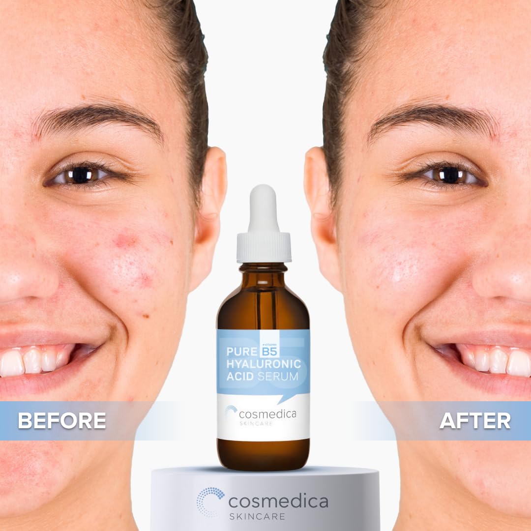 Hyaluronic Acid Serum With Vitamin B5 - Intense Hydration, Anti-Aging, Non-Greasy, Paraben Free, Face Serum - 2Oz