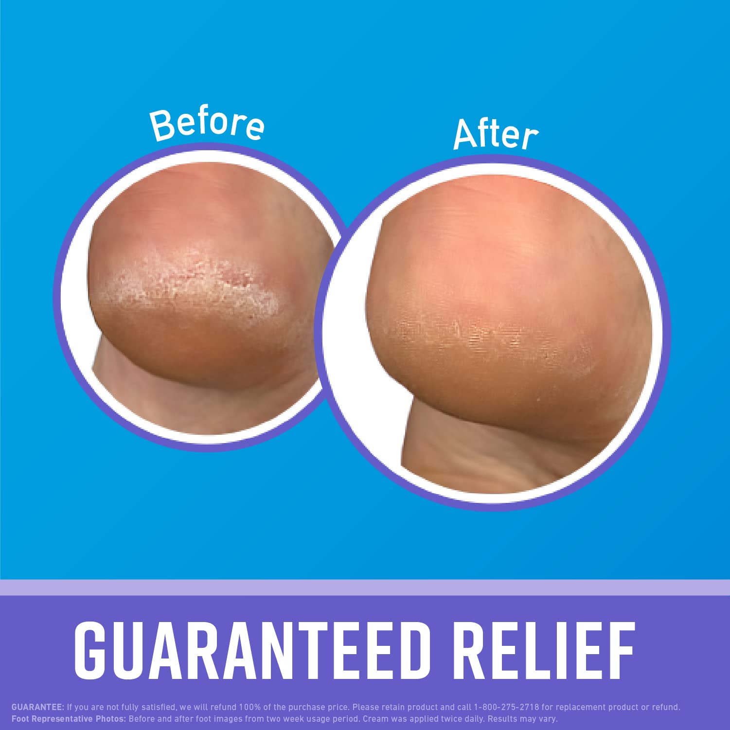 O'Keeffe'S For Healthy Feet Night Treatment Foot Cream, Guaranteed Relief For Extremely Dry, Cracked Feet, Visible Results In 1