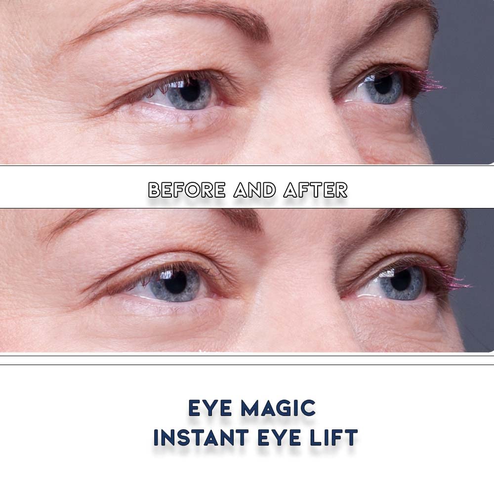 Eye Magic Premium Instant Eye Lift (Small/Med Kit + Emollient Gel) Lifts and Defines Droopy, Sagging, Hooded, Eyelids For A Yout