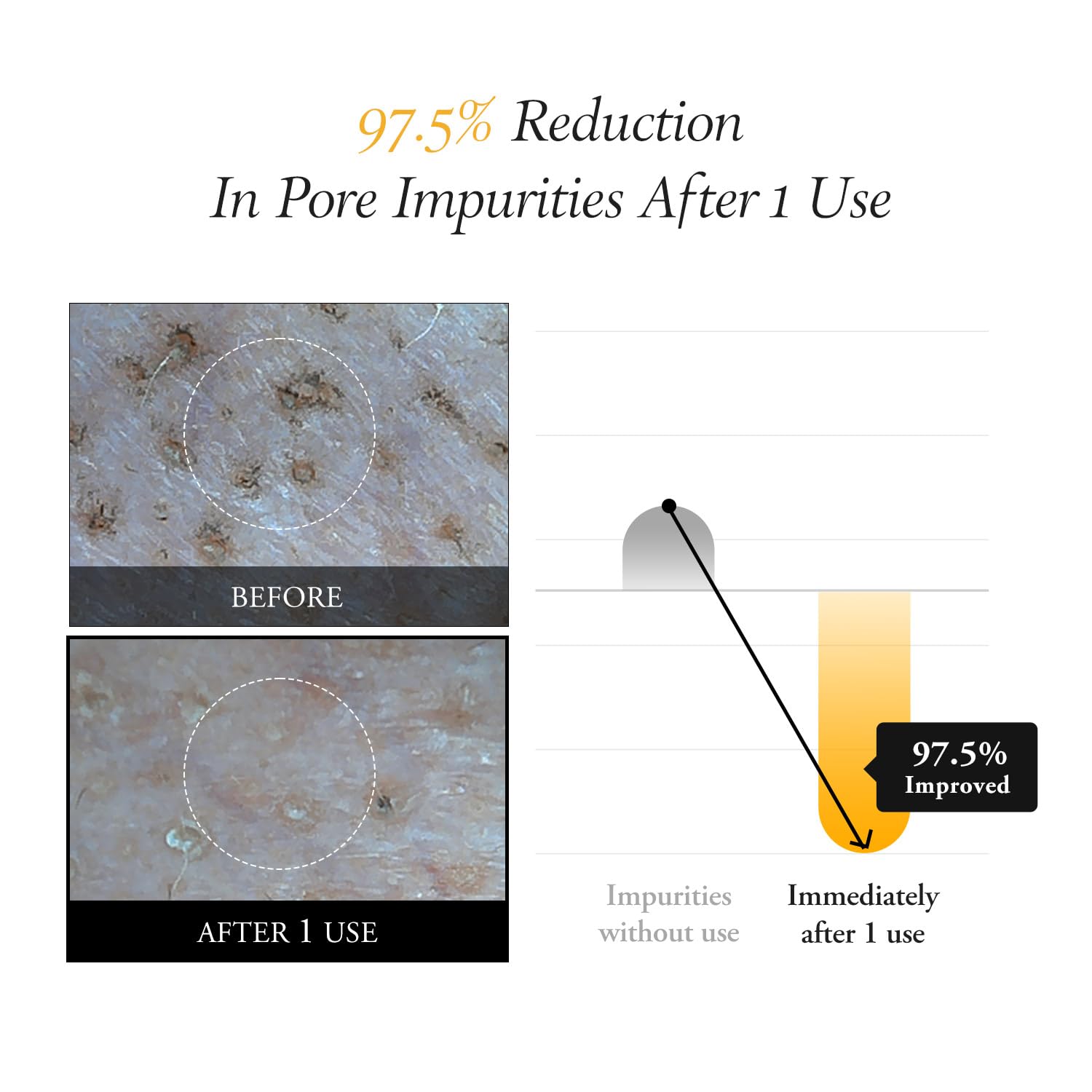 Aprilskin Calendula Peel Off Pore Minimizing Facial Mask | Vegan | Blackhead Remover, Exfoliating, Deep Cleansing | Pha Bha | Ko