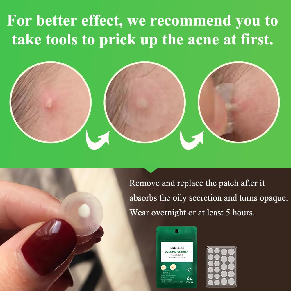 Acne Pimple Patch (66Count), Breylee Tea Tree Oil Pimple Patch Acne Pimple Healing Patch Zit Patch Acne Patch Hydrocolloid Patch