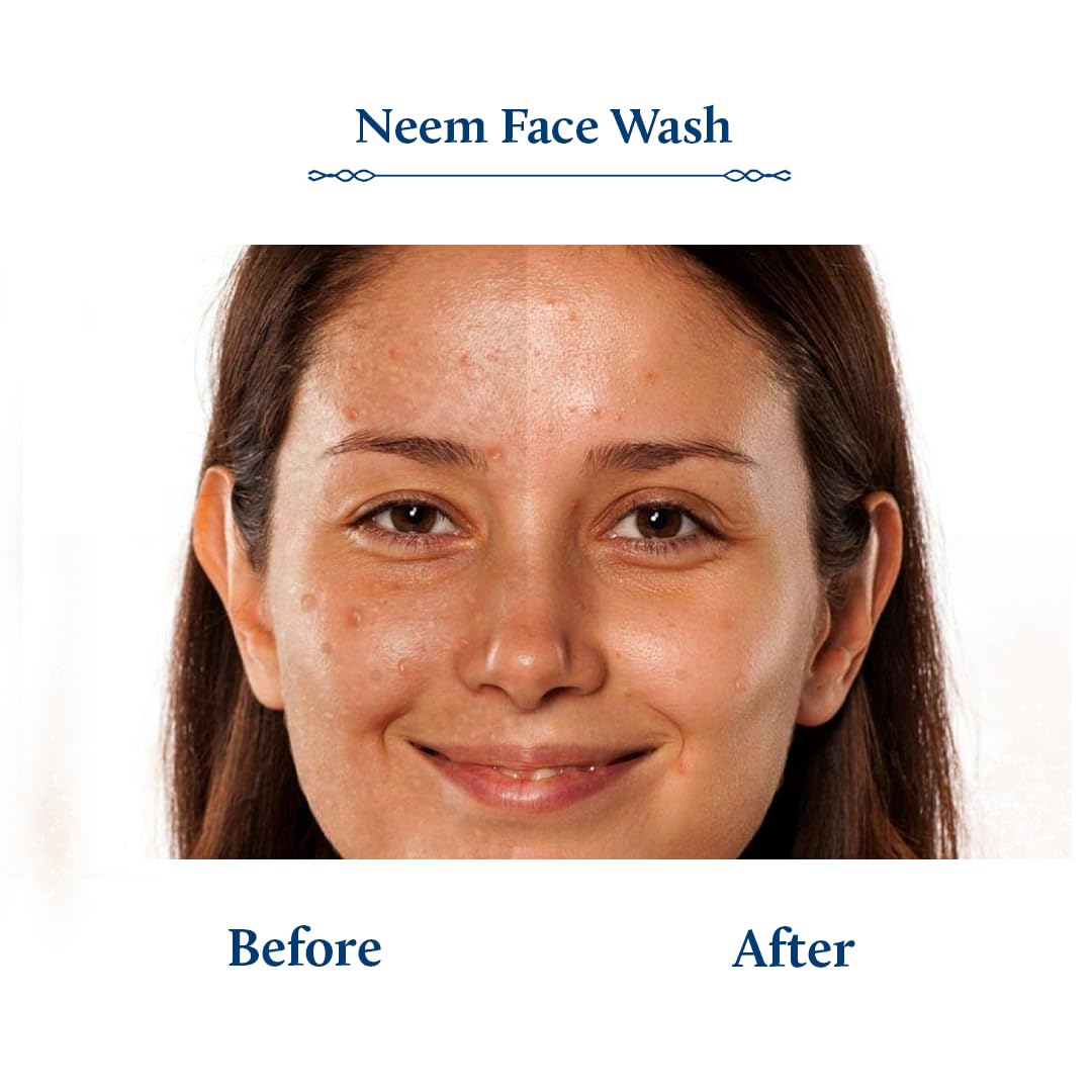 Blue Nectar Vitamin C Face Wash For Women And Men | Anti Acne Face Wash With Neem & Honey | Natural Cleanser For Face With Ayurv
