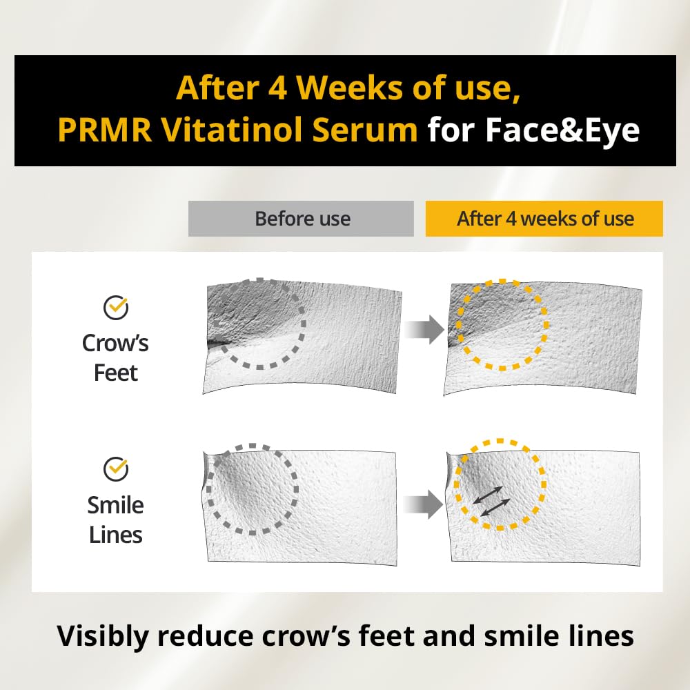 Primera (Prmr) Youth Radiance Vitatinol Serum - Retinol With Vitamin Bundle Set Vitamin A, C, Skin Care, Moisturizing, Shiny, El