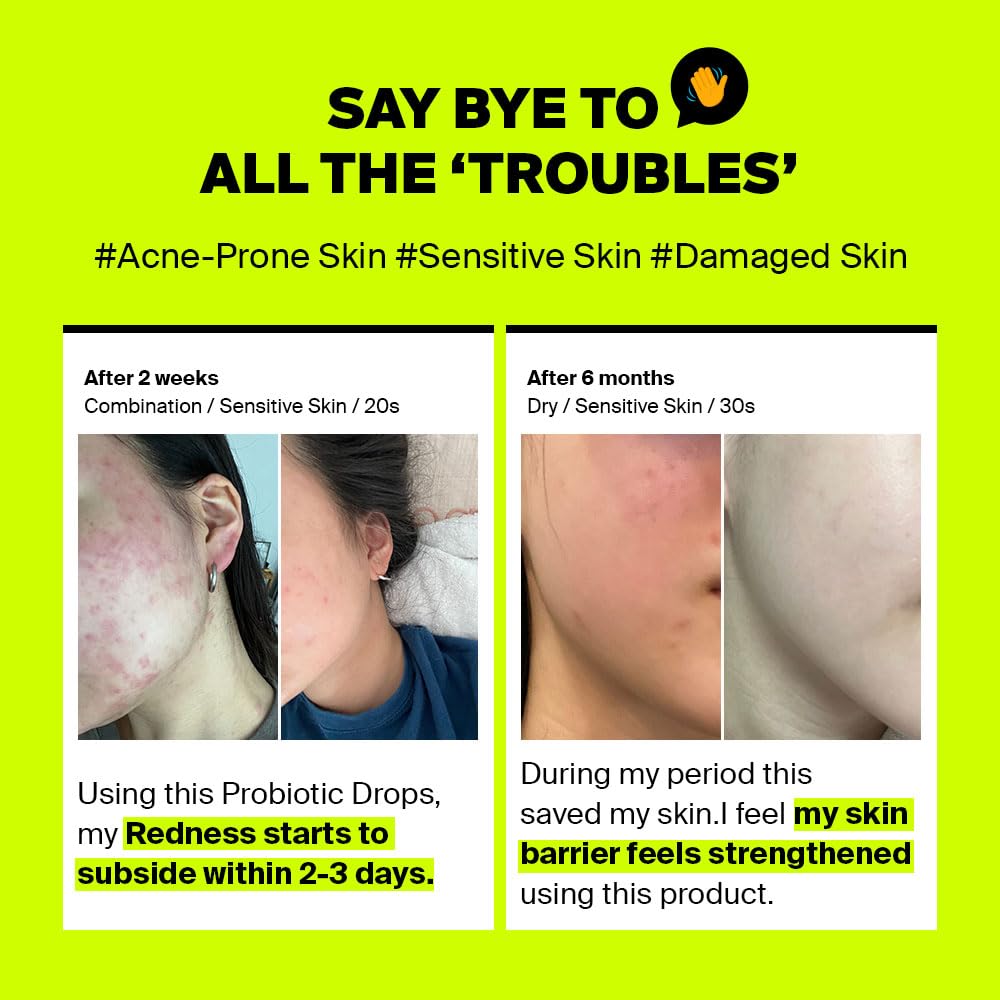 Purcell Pixcell Biom 2B/Ml - Restores Skin Barrier With Bifida, Lactobacillus Ferment Lysate, Korean Probiotic Drops For Acne Pr