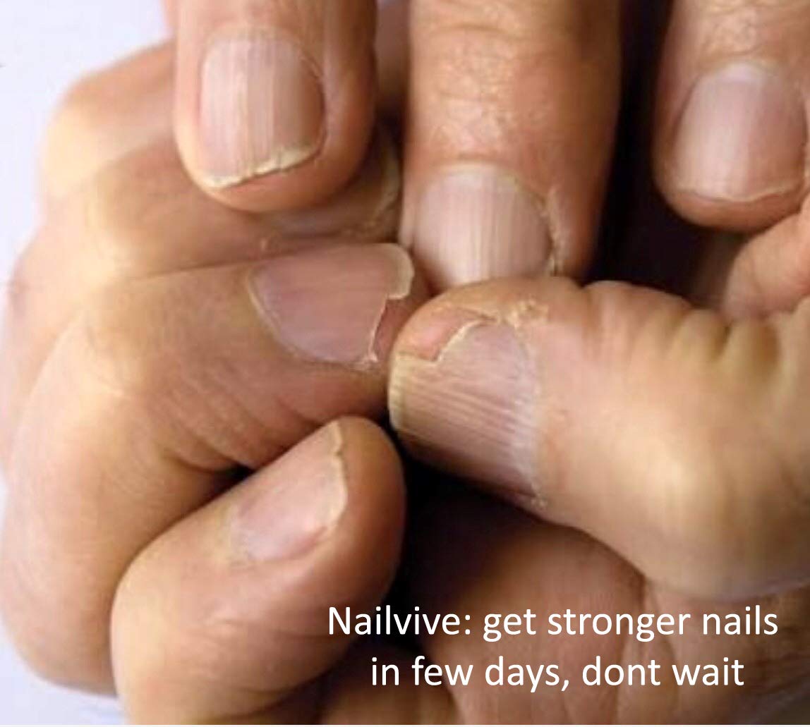 NAILVIVE Nail Serum Powerful Magic-like Silk Proteins Proven Natural Formula Strengthening Hardening nails Instantly Prevents Sp