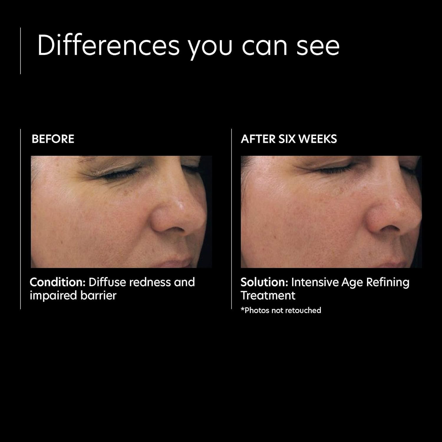 PCA SKIN Intensive Anti Aging Retinol Serum, 0.5% Pure Retinol Face Serum, Minimizes Fine Lines and Wrinkles, 1 fl oz Tube
