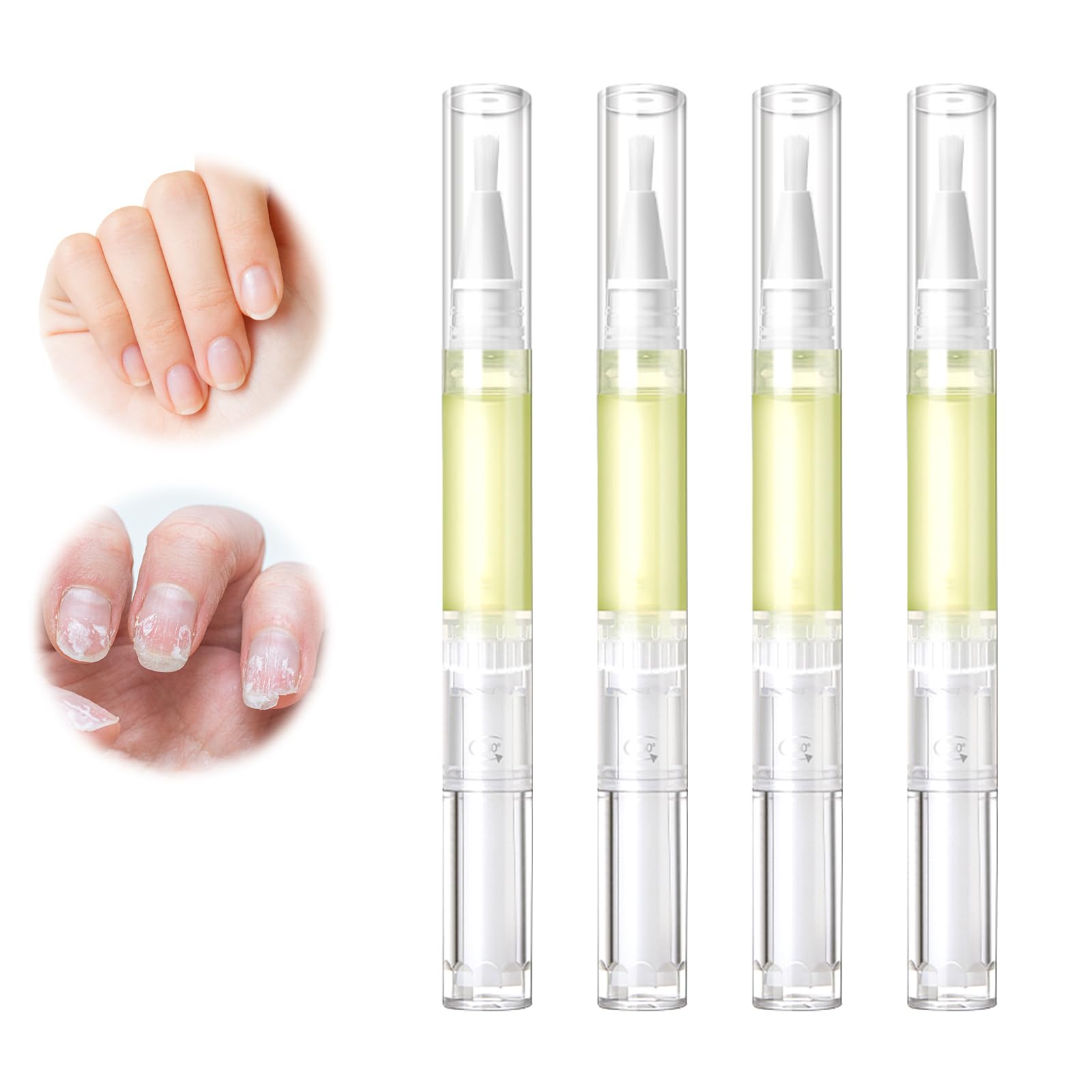 Radiant Nail Growth GIL, Radiant Nail Growth Oil Pen,Cuticle Oil for Nails,Nail Strengthener, For Moisturize Strengthen Nail Car