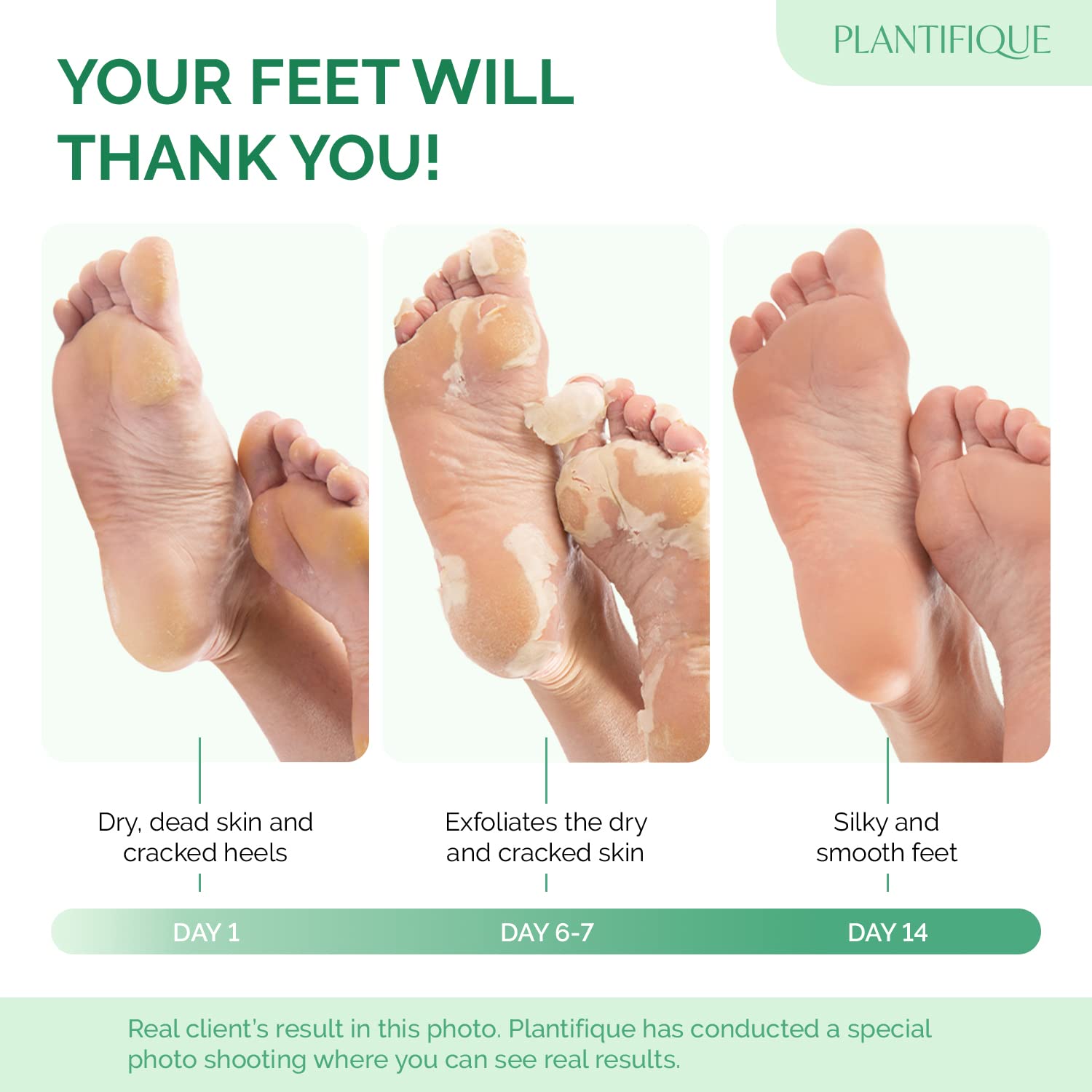 Plantifique Foot Peeling Mask - Dermatologically Tested To Repair Heels & Remove Dead Skin For Baby Soft Feet - Exfoliating Peel