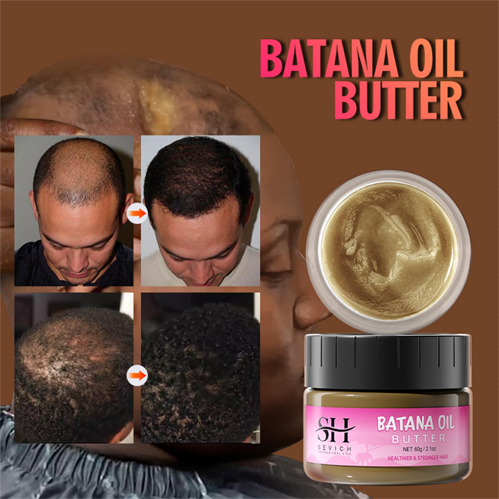 SEVICH Hair Butter with 100% Pure Raw Batana Oil - From Honduras for Growth, Repairing Damaged Tresses, Nourishing Thin Scalp an