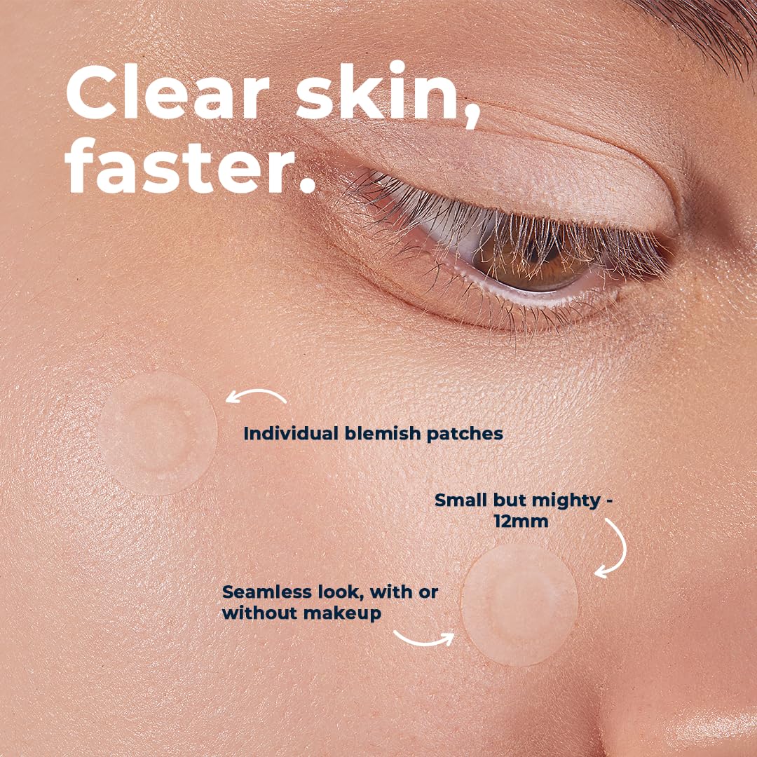 VitaMedica Clear Skin Spot Dots | Natural Blemish Spot Treatment Hydrocolloid Patches