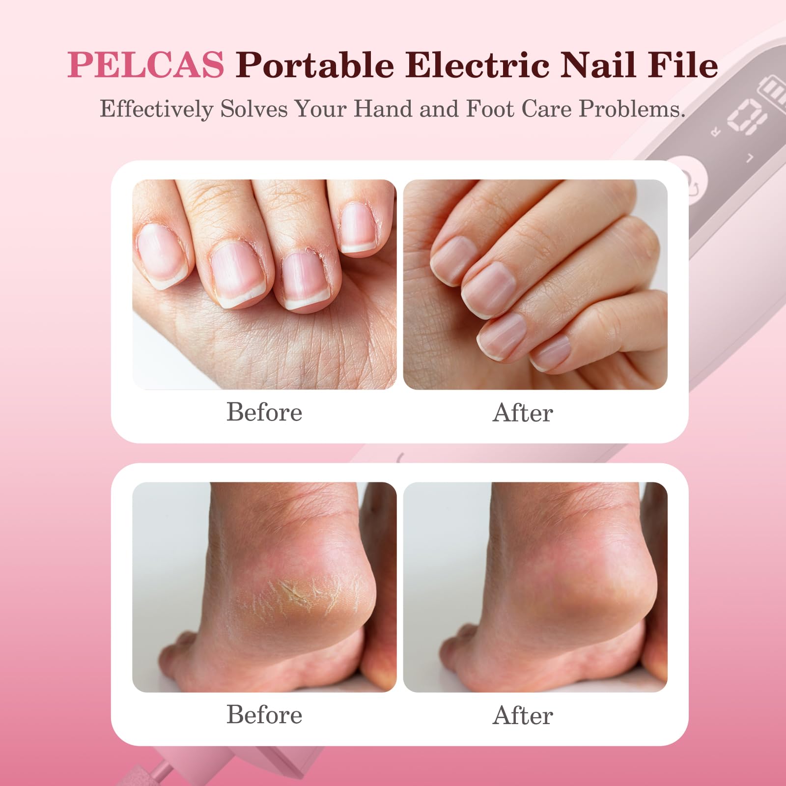 Pelcas Cordless Nail Drill, 10 Speeds Professional Electric Nail File With Led Light Portable Electric Toenail Files With Lcd Sc