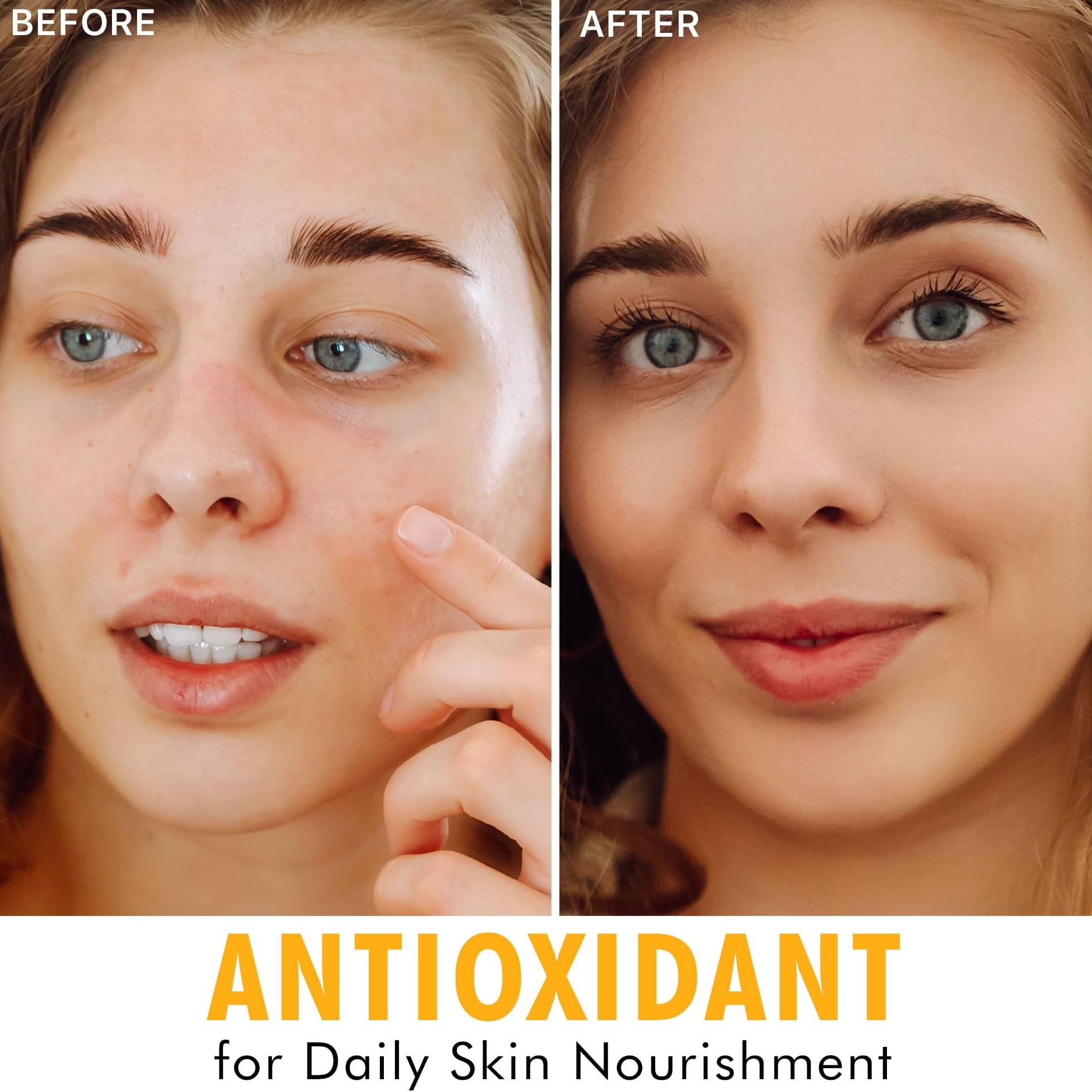 Vitamin C Face Serum - Usa Made With Natural & Organic Ingredients, Vitamin C Serum For Face, Skin Brightening Serum For Women,