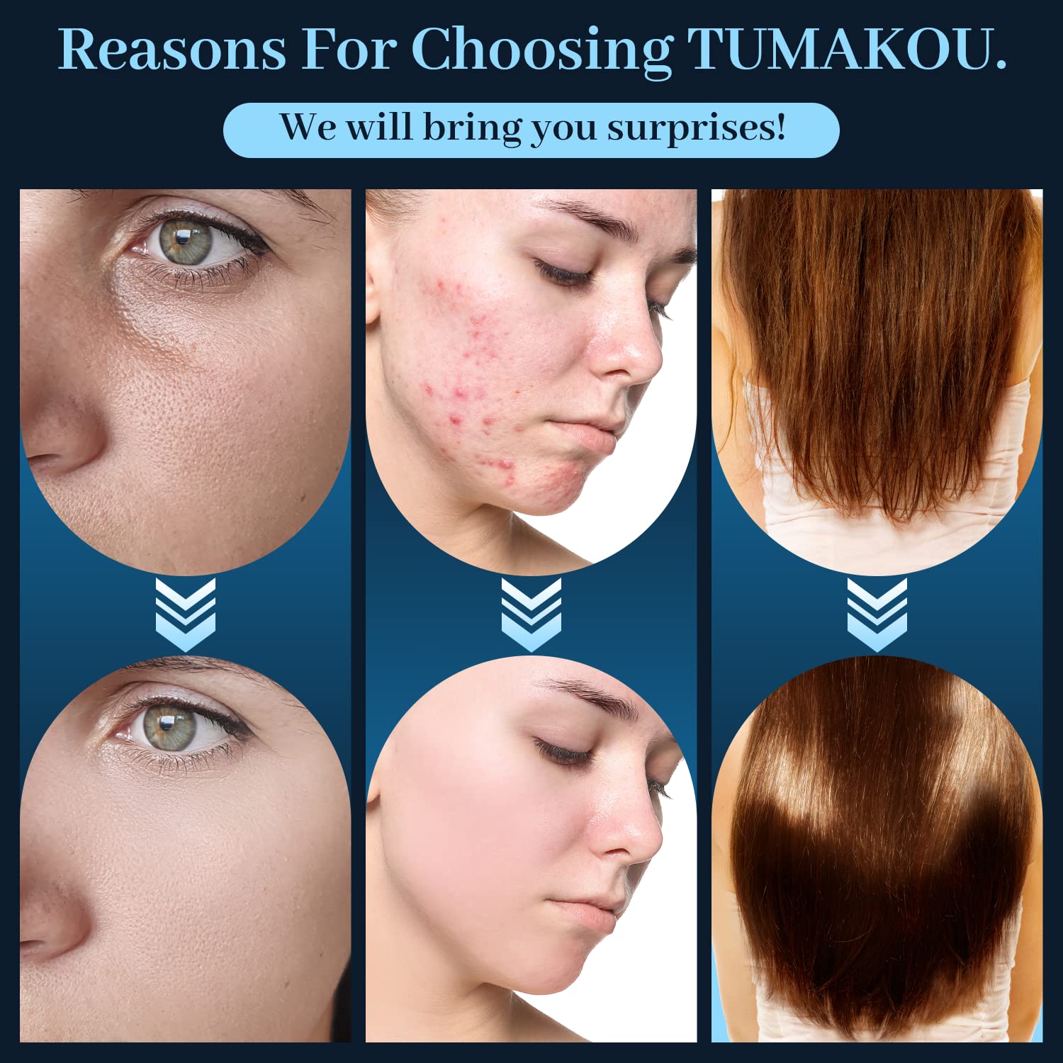 High Frequency Facial Wand - TUMAKOU Portable Handheld Blue High Frequency Facial Machine - 4 Different Blue Glass Tubes for Ski
