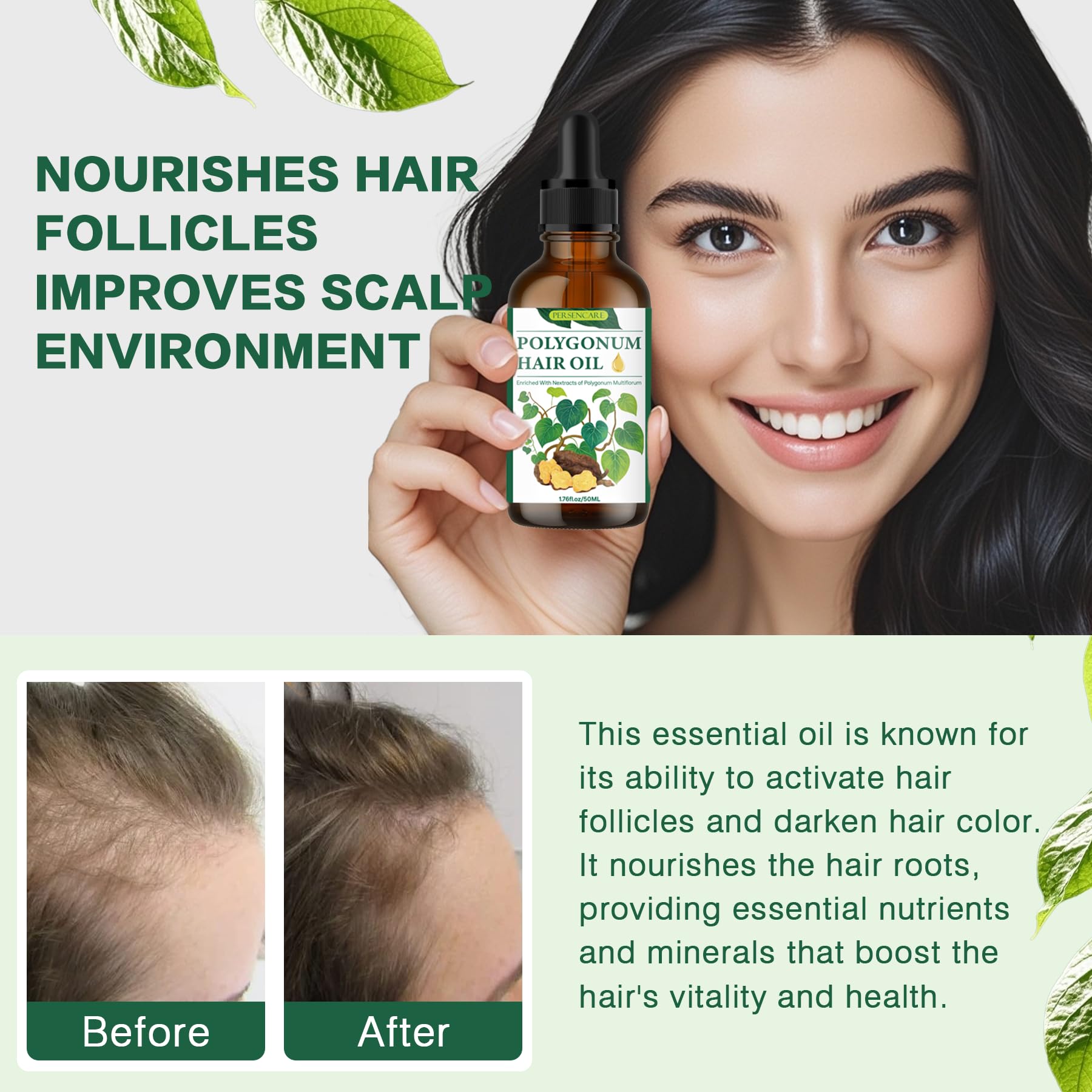 VAEYAE Natural Polygonum Multiflorum Hair Essential Oil, Nourish the Scalp & Strengthen Hair Roots, Usma Grass Promote Hair Grow