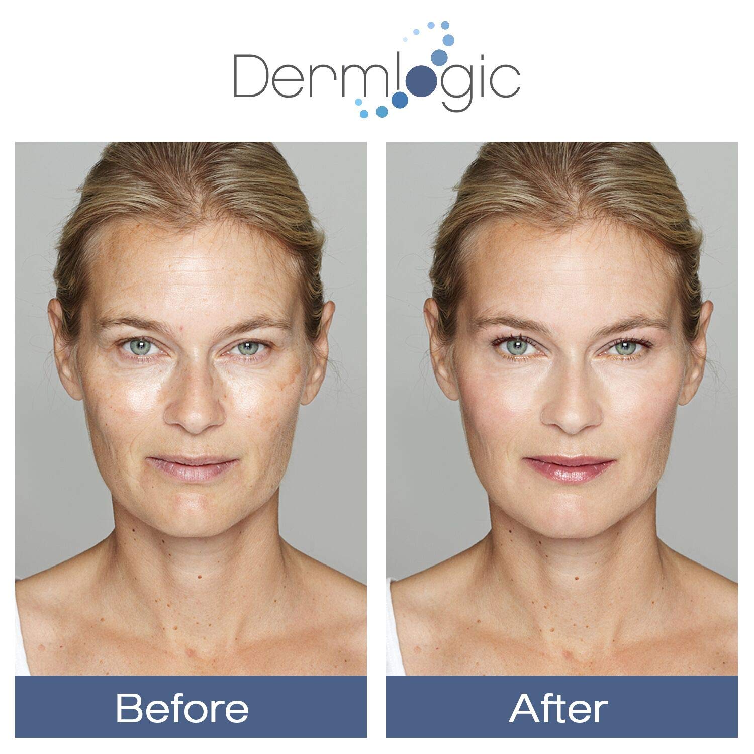 Glycolic Cream 15% - Natural Anti Aging Exfoliator to Smooth Away Fine Lines & Wrinkles & Improve a Dull Looking Complexion. Inc