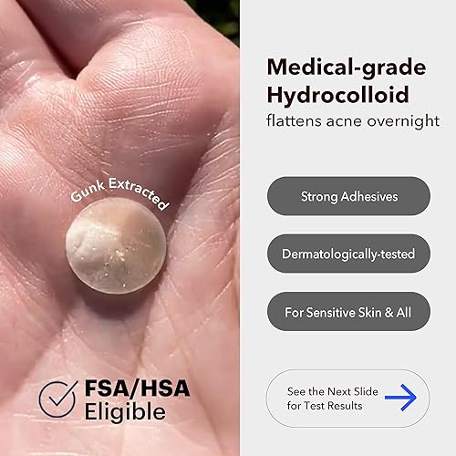 Avarelle Acne Cover Patch  Hydrocolloid Acne Pimple Patches  Zit Patches For Blemishes, Zits And Breakouts With Tea Tree, Calend