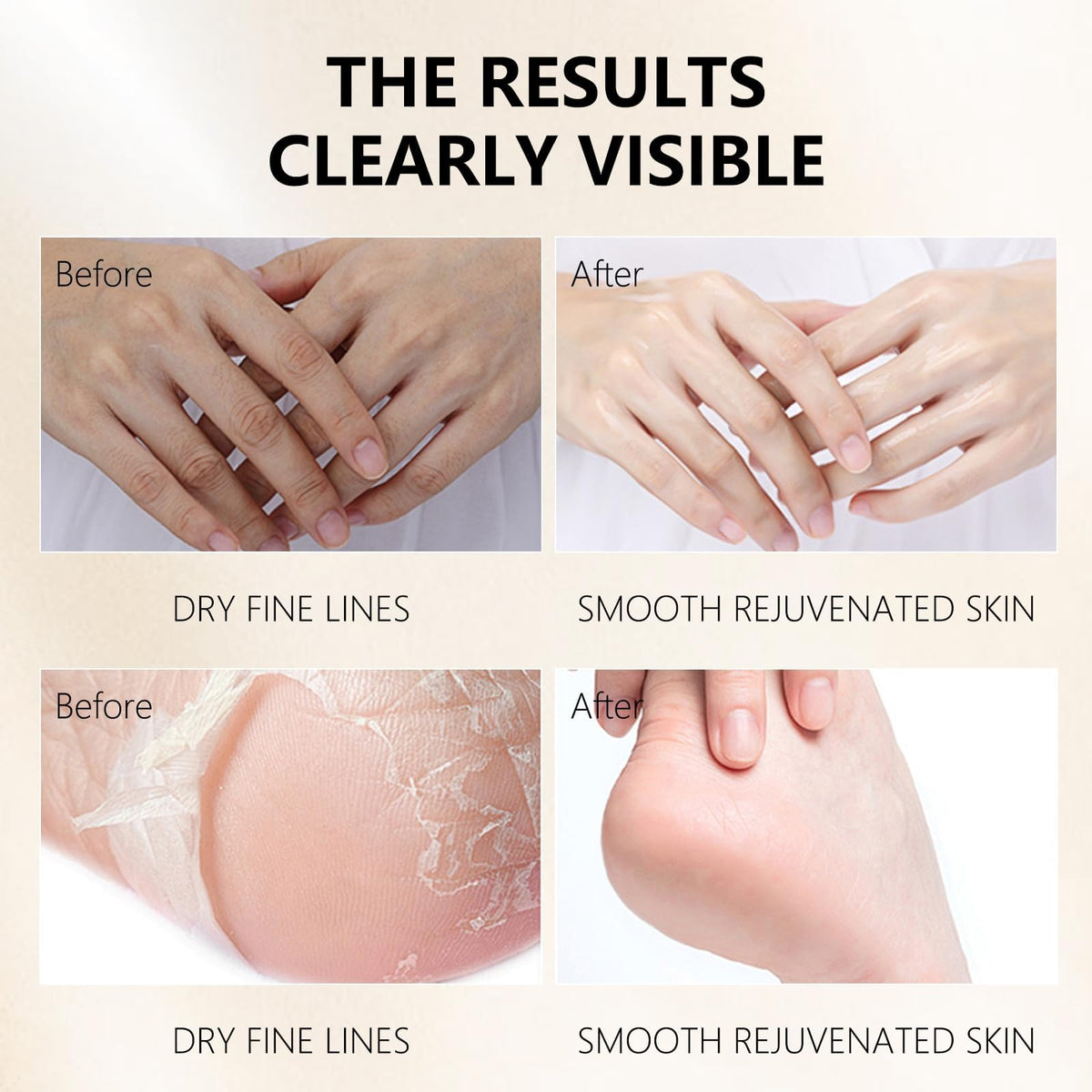 Guoyaolifu Hydrating Hand Foot Masks Set,Moisturizing Hand Mask For Dr ...