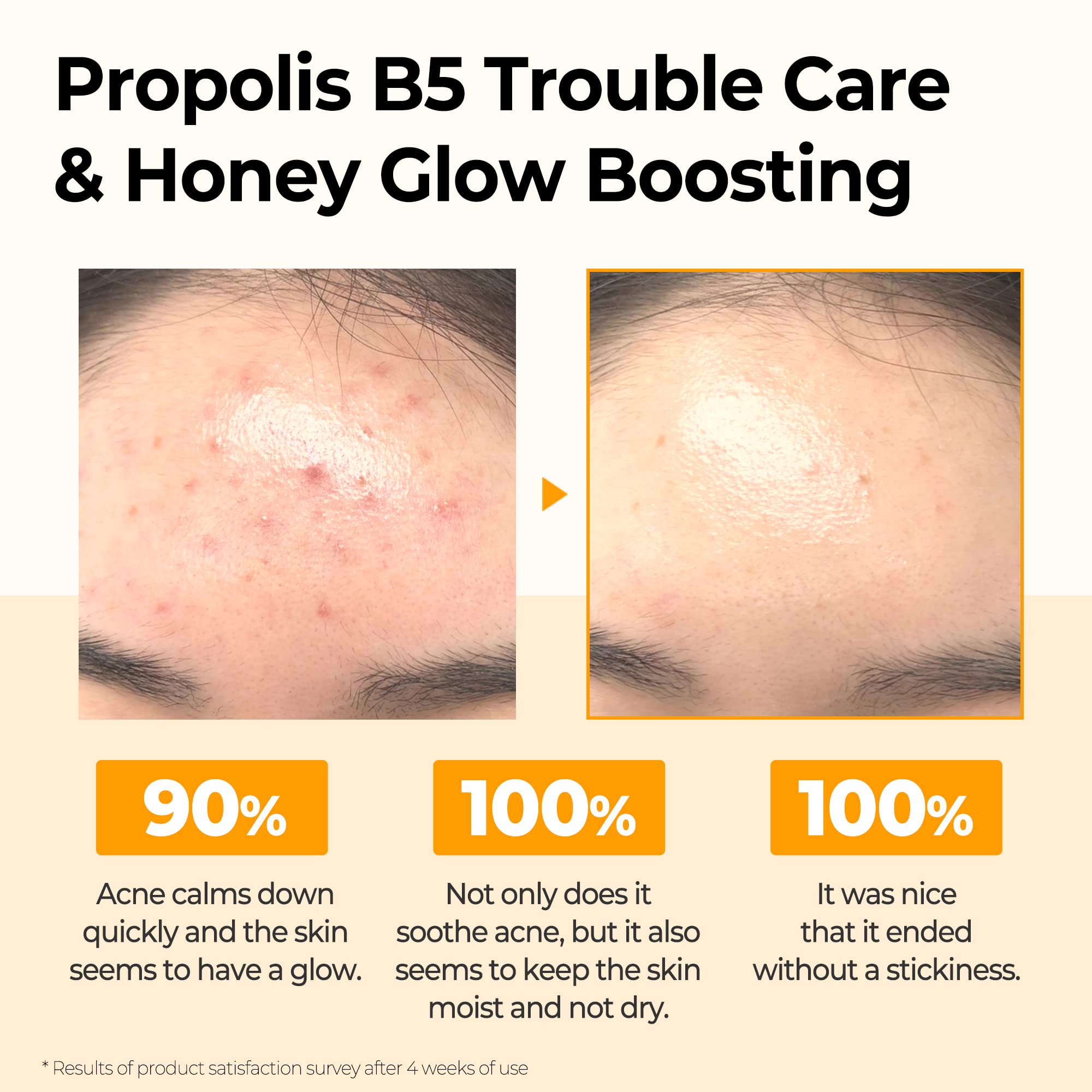 Some By Mi Propolis B5 Glow Barrier Calming Toner - 5.07Oz, 150Ml - Made From Propolis And Panthenol For Glass Skin - Skin Brigh