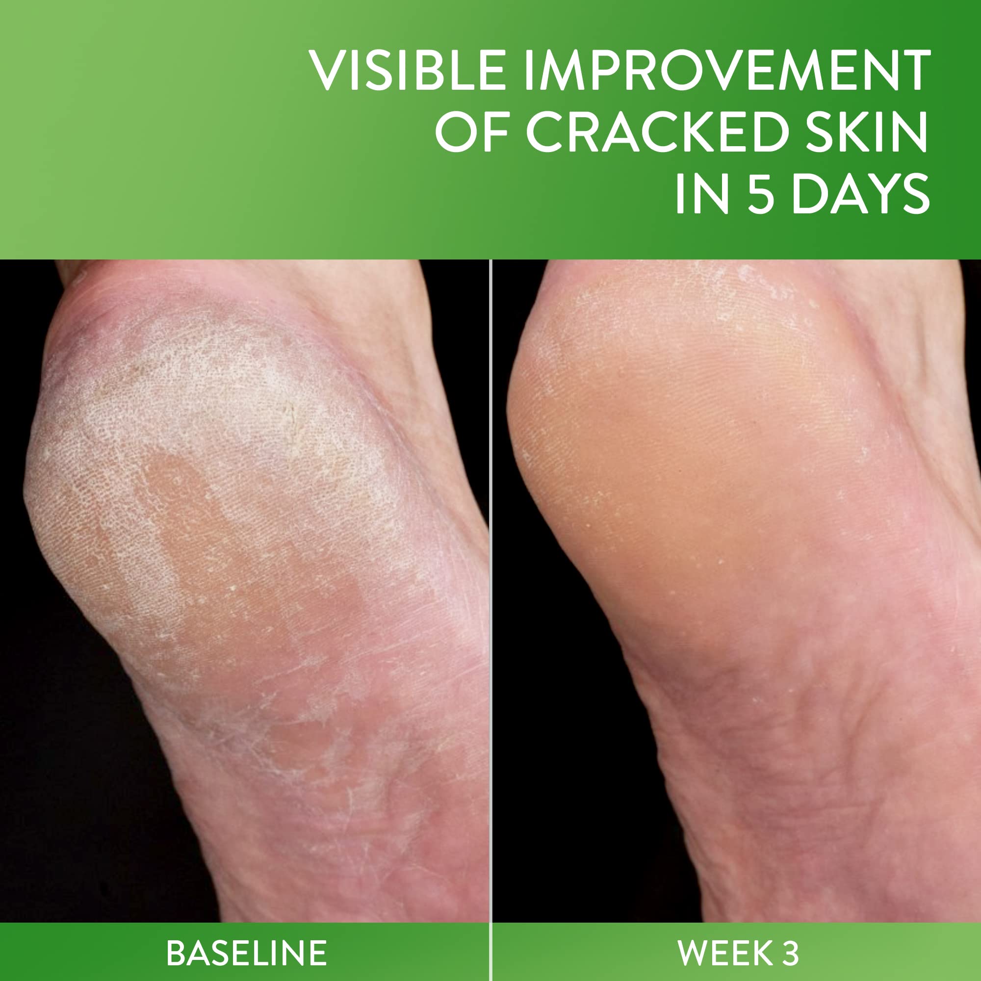 Cetaphil Cracked Skin Repair Balm, 3 Oz, For Very Rough & Cracked, Sensitive Skin, Protects, Soothes & Restores Deeper Cracks, H