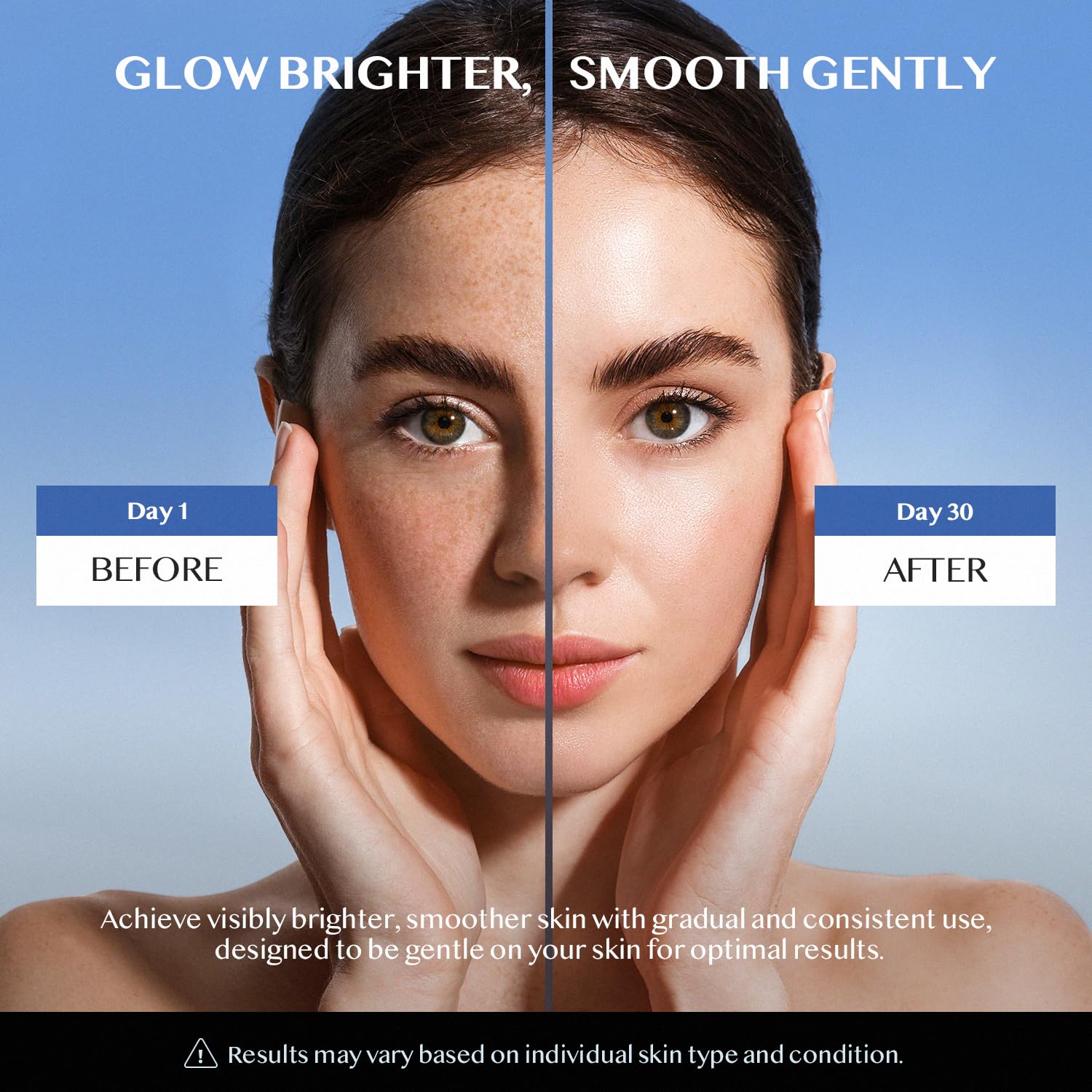 Dark Spot Remover for Face & Body - Dark Spot Corrector for Face - Hyperpigmentation, Age Spot, Sun Spot, Melasma & Freckles - B