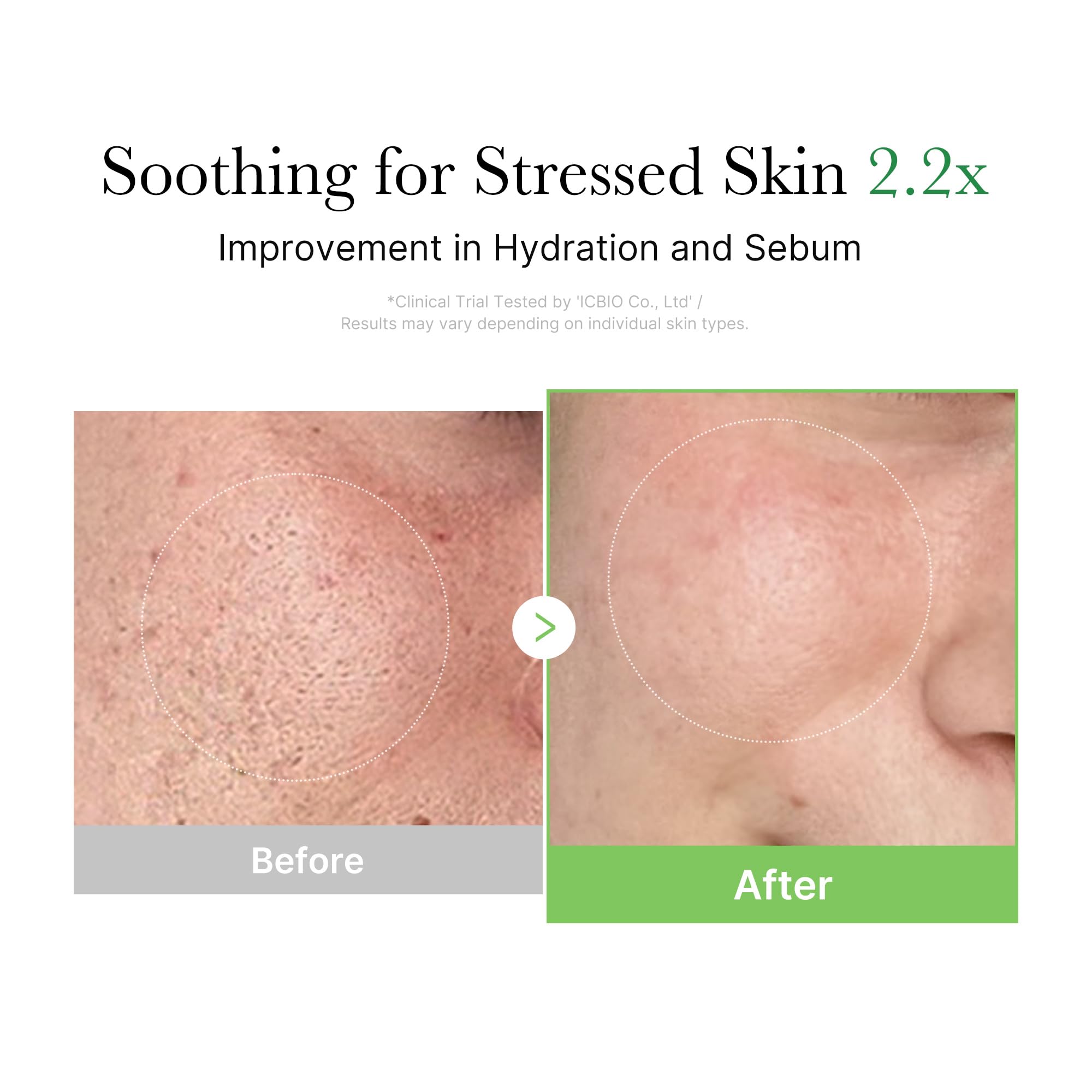 Medicube Exosome Cica Tea Tree Cream For Sensitive Skin With Centella Asiatica Help Reduce Redness And Breakouts. | Low-Irritati