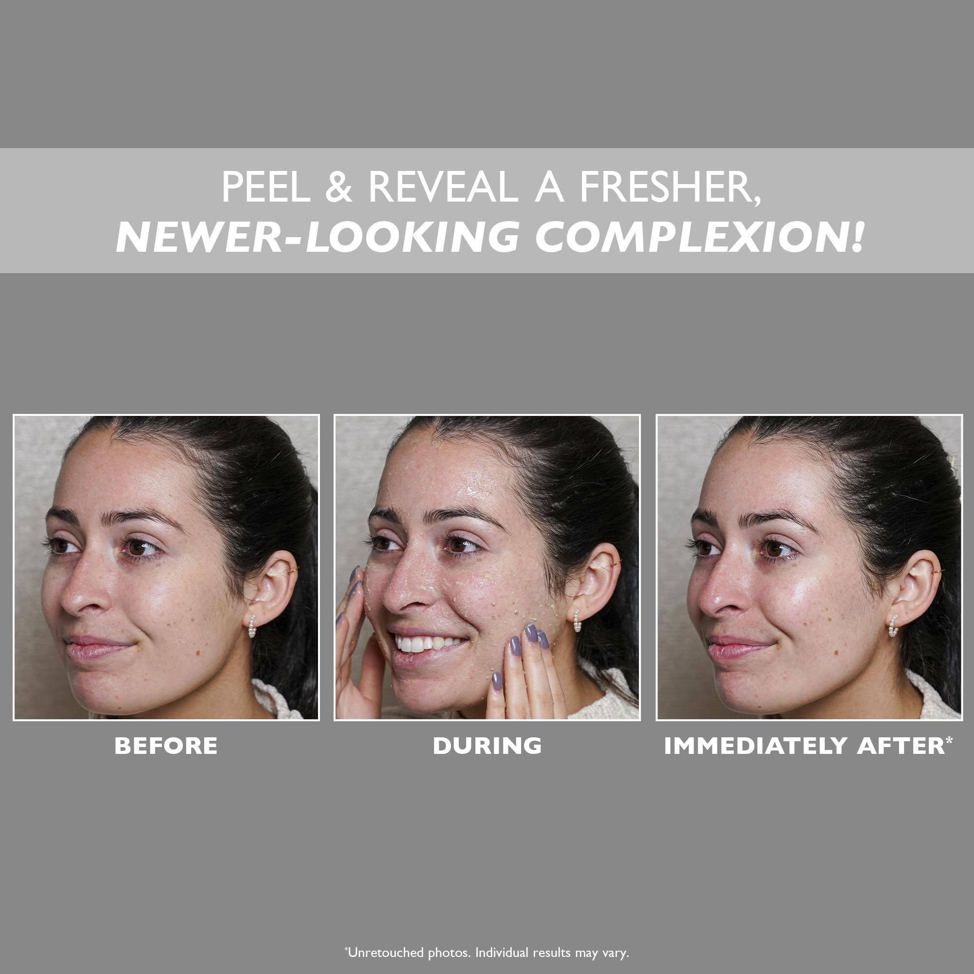 Peter Thomas Roth Firm X Peeling Gel