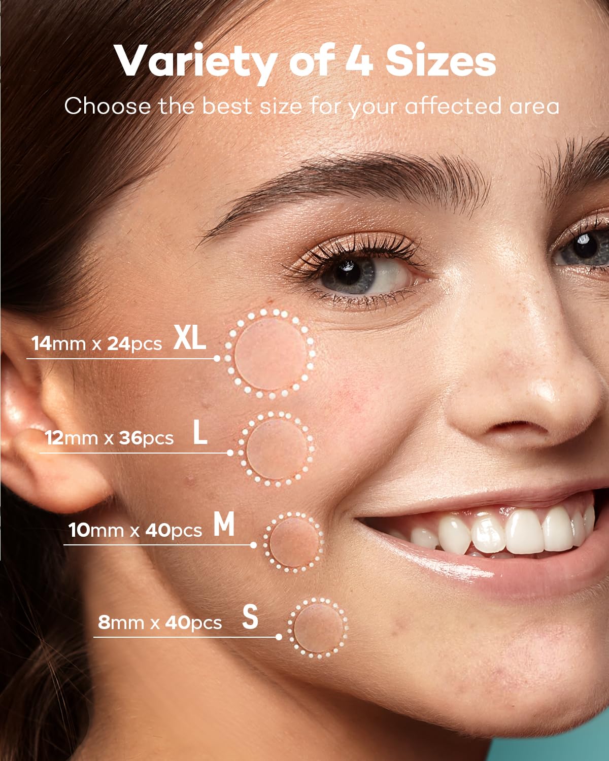 Acne Patch Pimple Patch, 4 Sizes 140 Patches Acne Absorbing Cover Patch, Hydrocolloid Invisible Acne Patches For Face Zit Patch