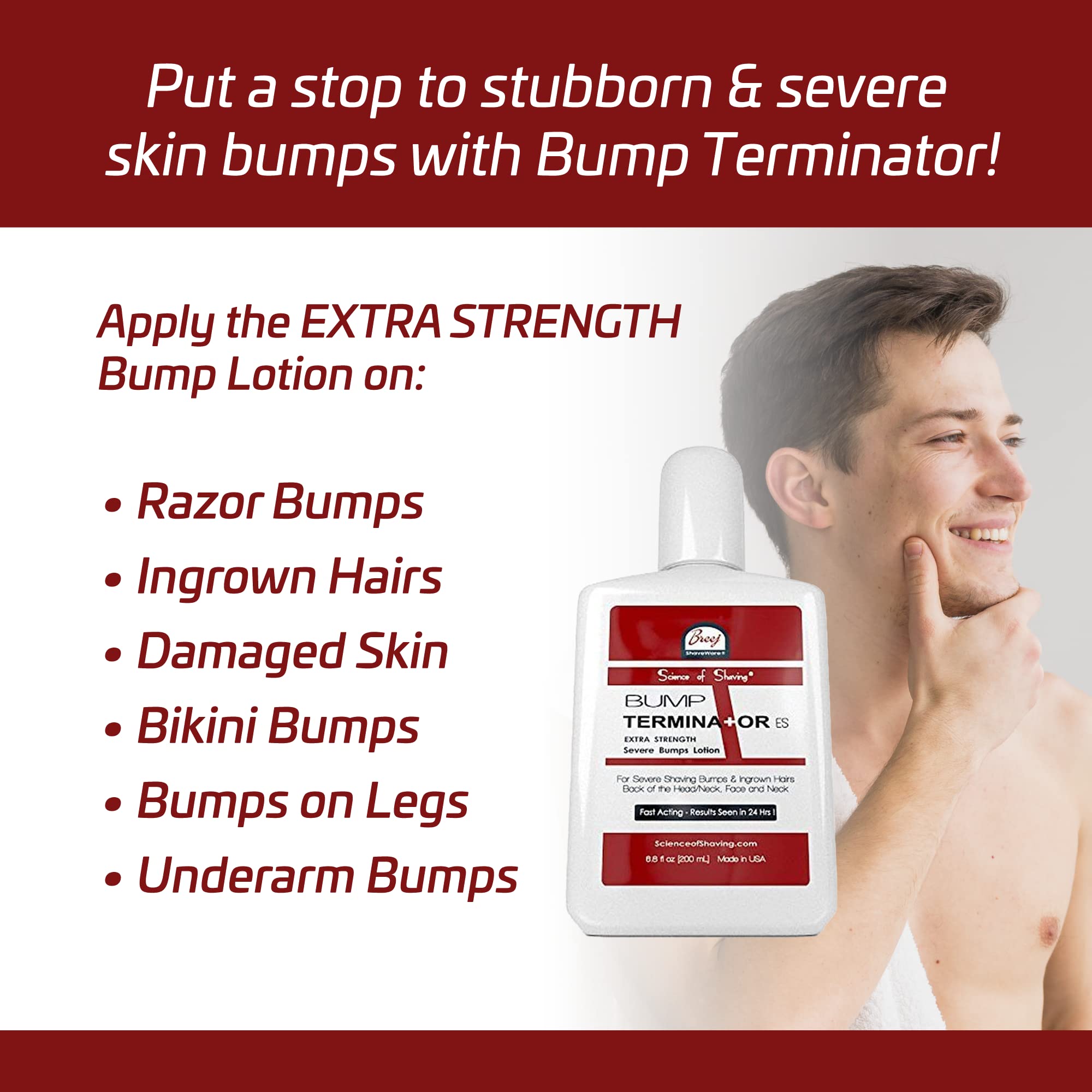 BUMP TERMINATOR Extra Strength Severe Bumps Lotion by Breej, 6.8 fl oz ...