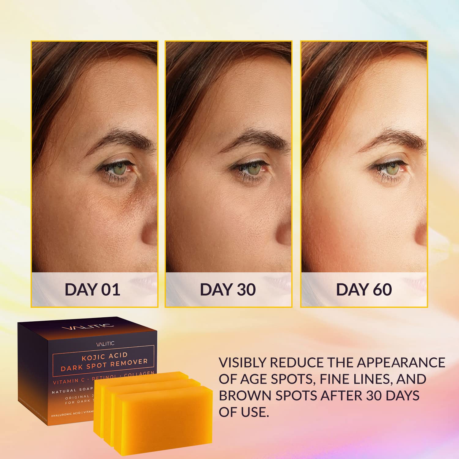 Valitic Unisex Dark Spot Corrector Bar, 100G - Exfoliating, Sls And Paraben-Free Turmeric Soap For Skin Tone Correction, Vitamin