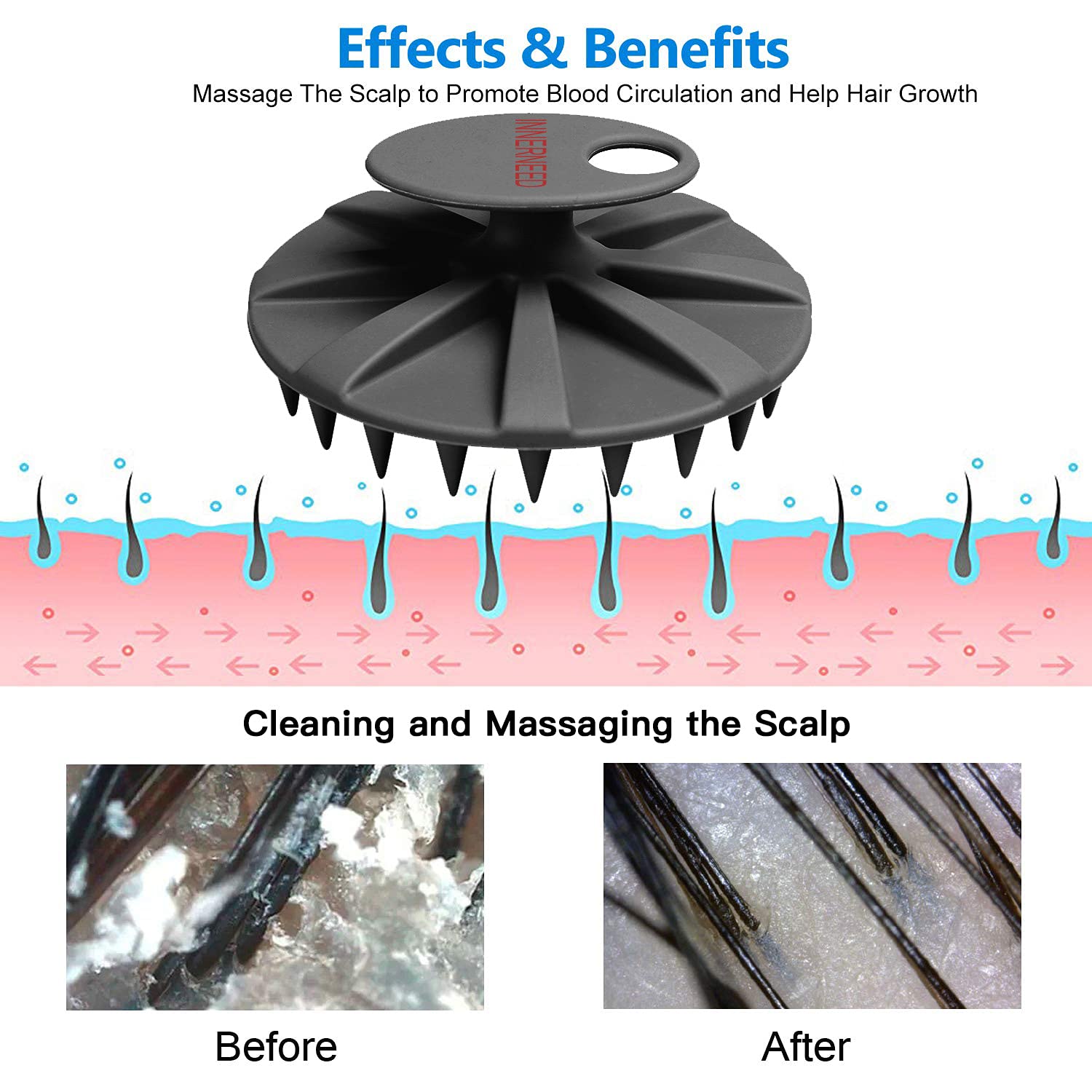 INNERNEED Scalp Care Massager Brush - Soft Silicone, Black, Manual Head Scrubber for Hair Growth & Dandruff Removal, Model IN202109080001