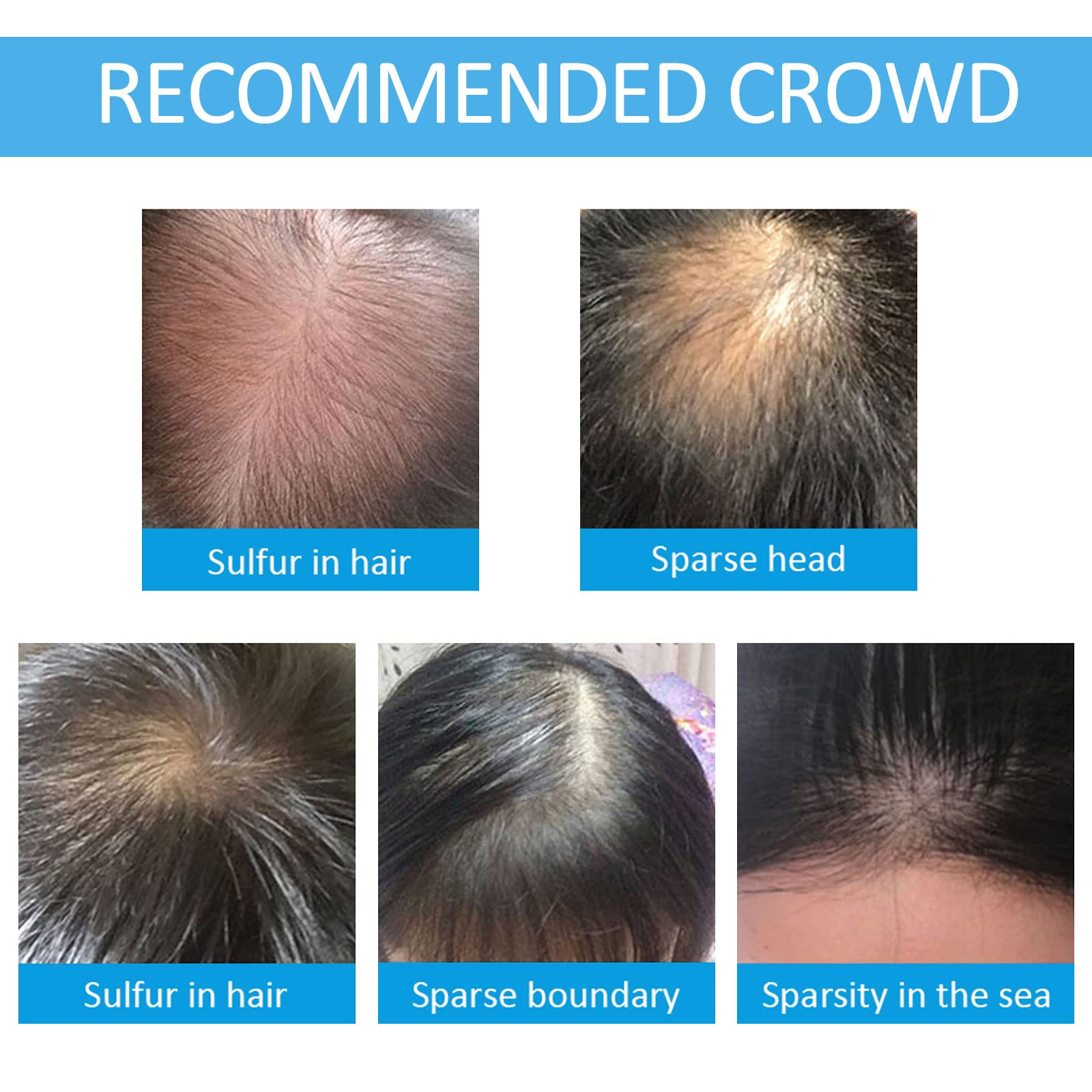 SHIFAKOU Hair Building Fibers - Black, 27.5g, Spray Applicator, Natural Look, Conceals Thinning Hair for Men & Women