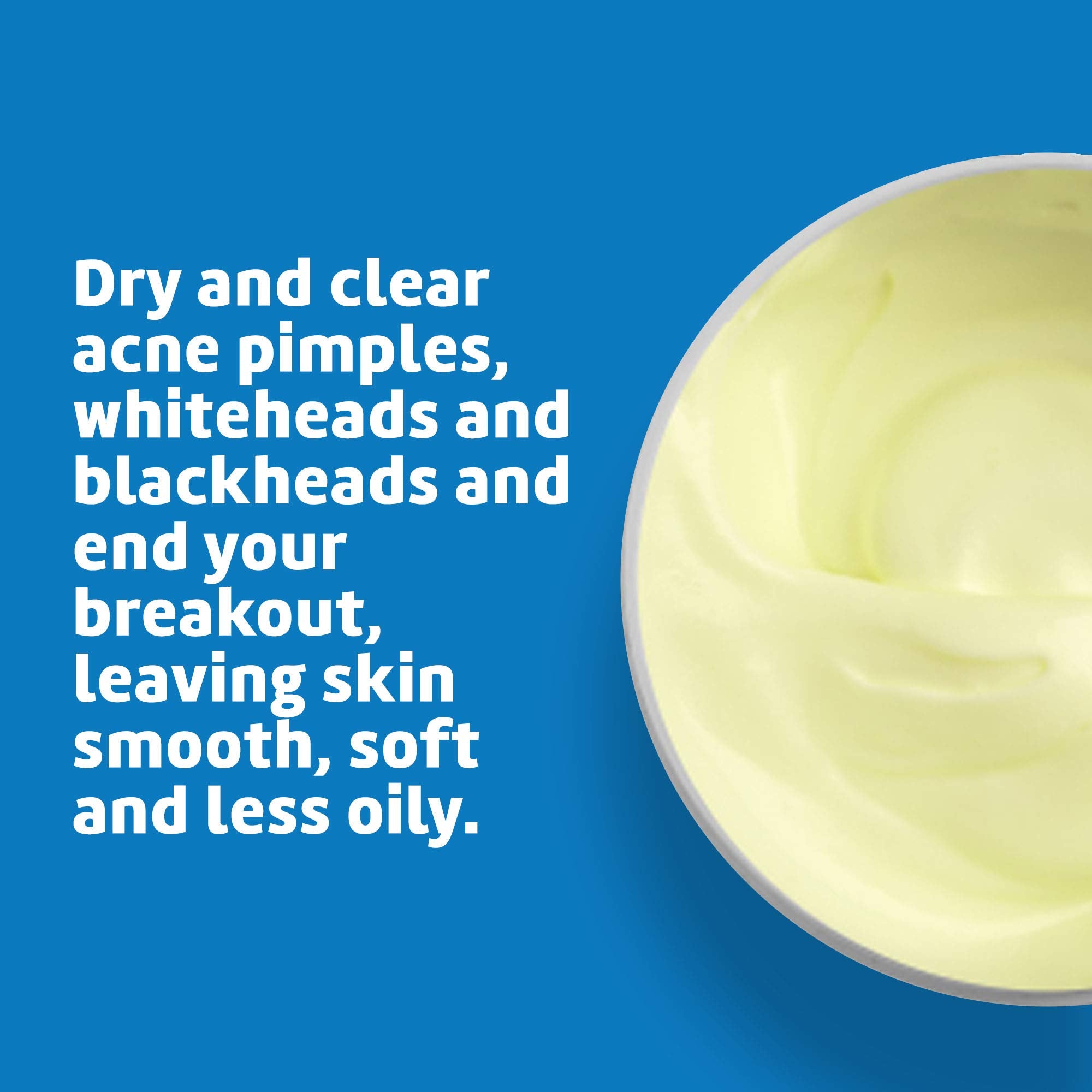 De La Cruz 10% Sulfur Ointment - Cystic Acne Treatment for Face and Body - Daily 10 Min Spot Treatment Mask - Safe and Effective