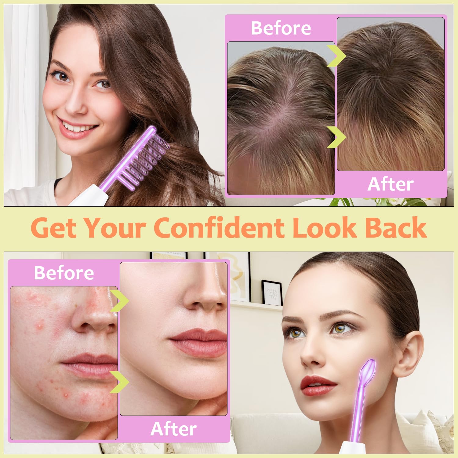 High Frequency Facial Wand - Uaike 4 In 1 Violet Portable Handheld High Frequency Facial Machine - At Home Face Skin Wand Device