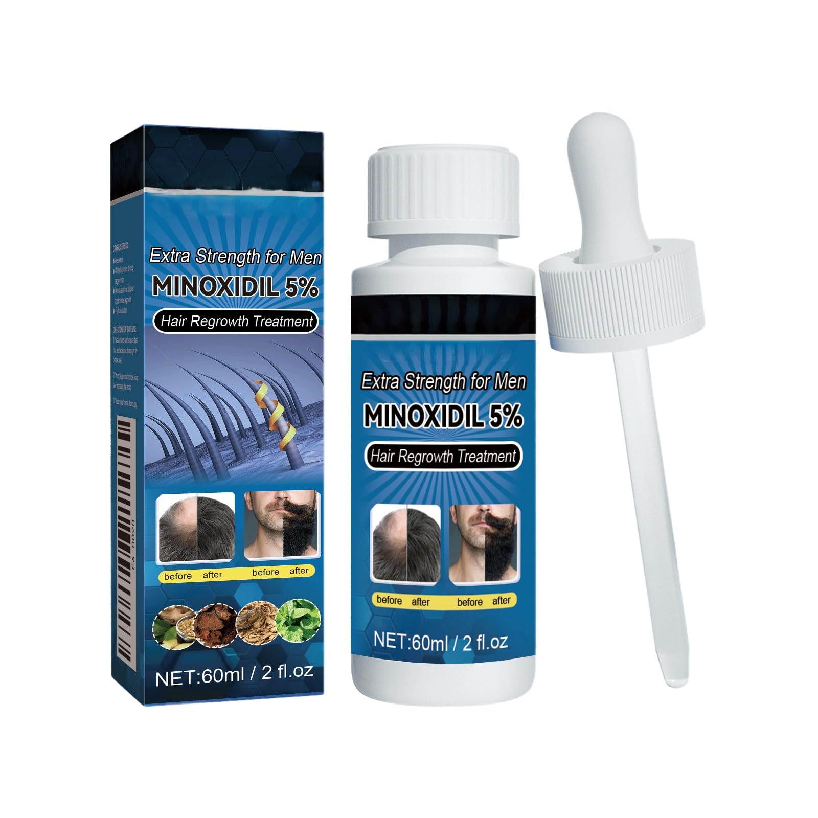 Minoxidil 5% Extra Strength Hair Regrowth Treatment for Men, Activates Dormant Follicles, Improves Microcirculation, 2 fl oz