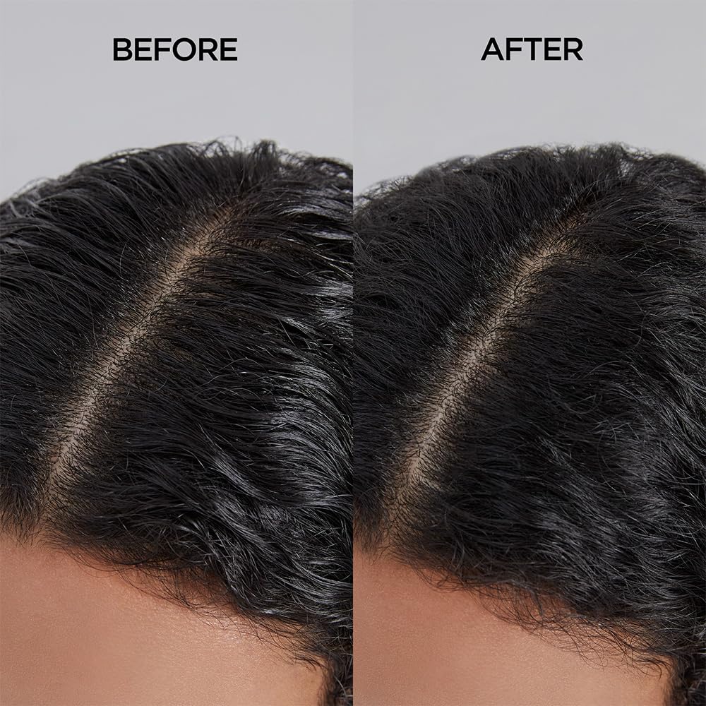 Ayunche Refreshing Shampoo For Oily Scalp, 11.8Oz Purifying & Cool Down | Powerful Cooling & Deep Cleansing | Anti-Dandruff Sham