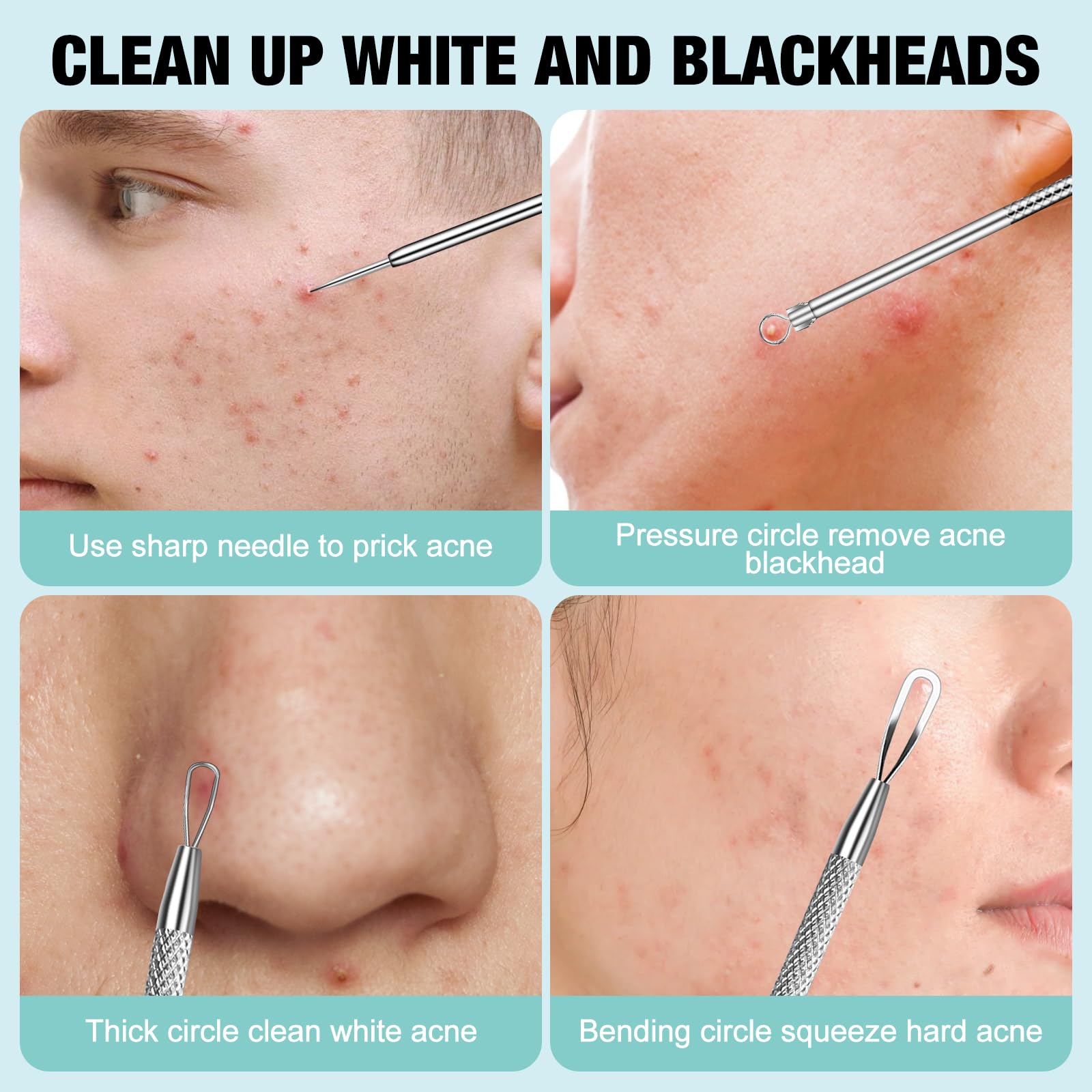 MUIIGOOD 3Pcs Blackhead Remover Pimple Popper Tool Kit Pimple Extractor Acne Treatment Surgical Grade Blackhead Comedone Removal