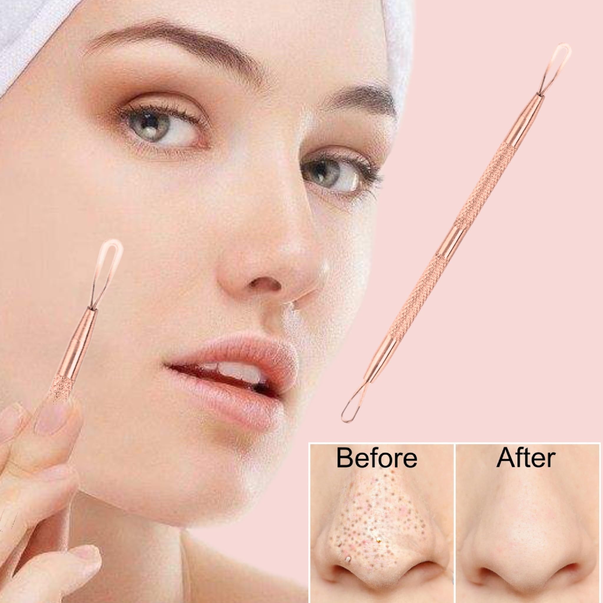 1 Professional Stainless Steel Blackhead Remover Blemish Extractor Tool - Acne Skin Nose Face Tzone Whitehead Zit Pimple Popper