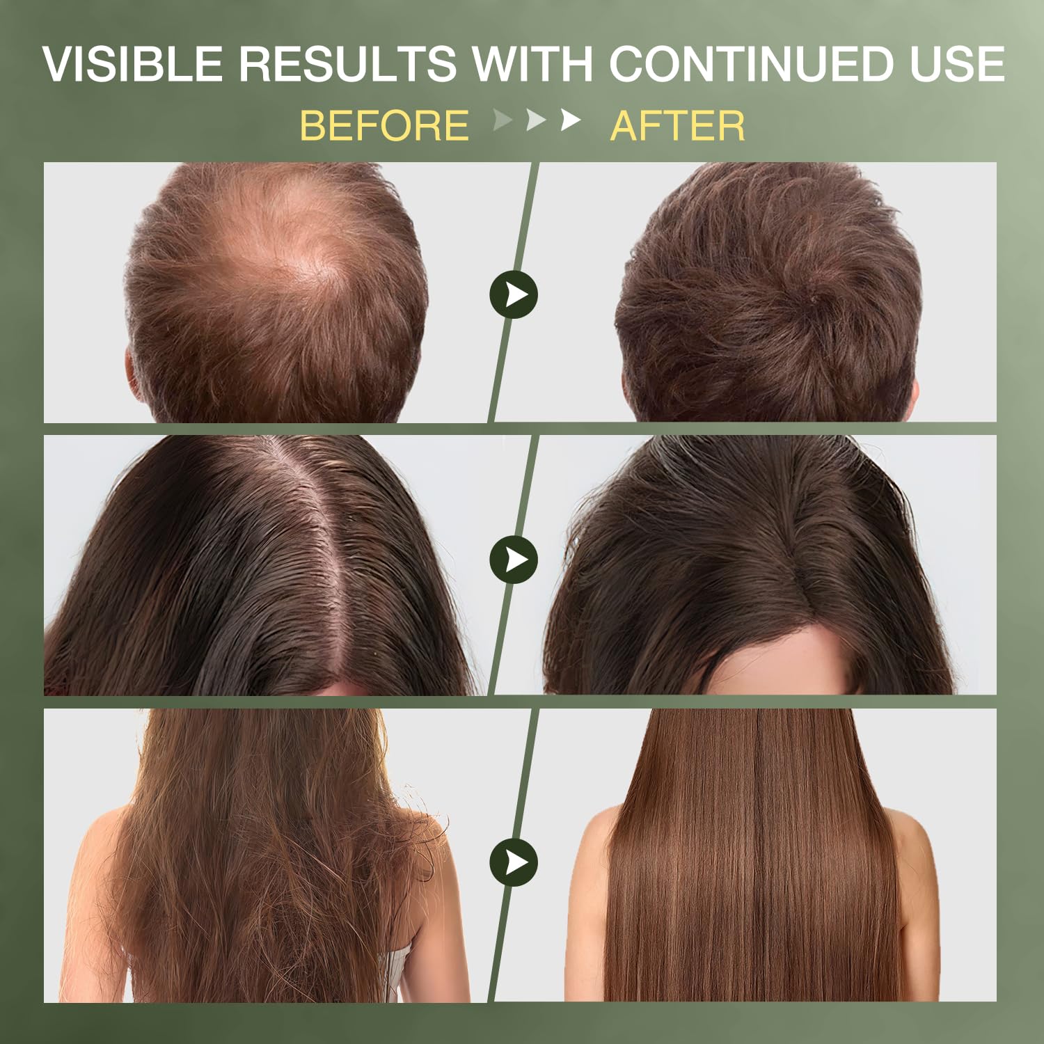 ulluxe Raw Batana Oil - 100% Natural Hair Growth Oil, 4.23 Fl Oz, Brown, Organic Treatment for Thicker Hair & Scalp Care