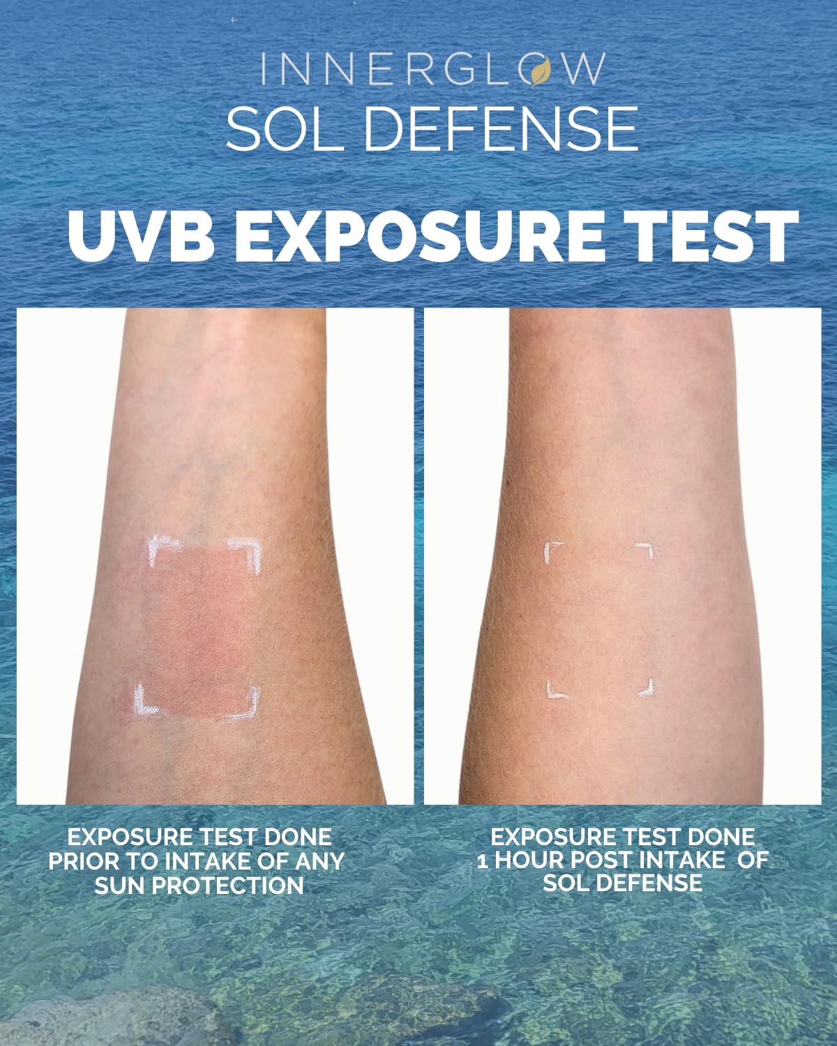 Inner Glow Sol Defense Gummies - Dermatologist and Plastic Surgeon developed to fight photoaging, Polypodium Leucotomos and Niac