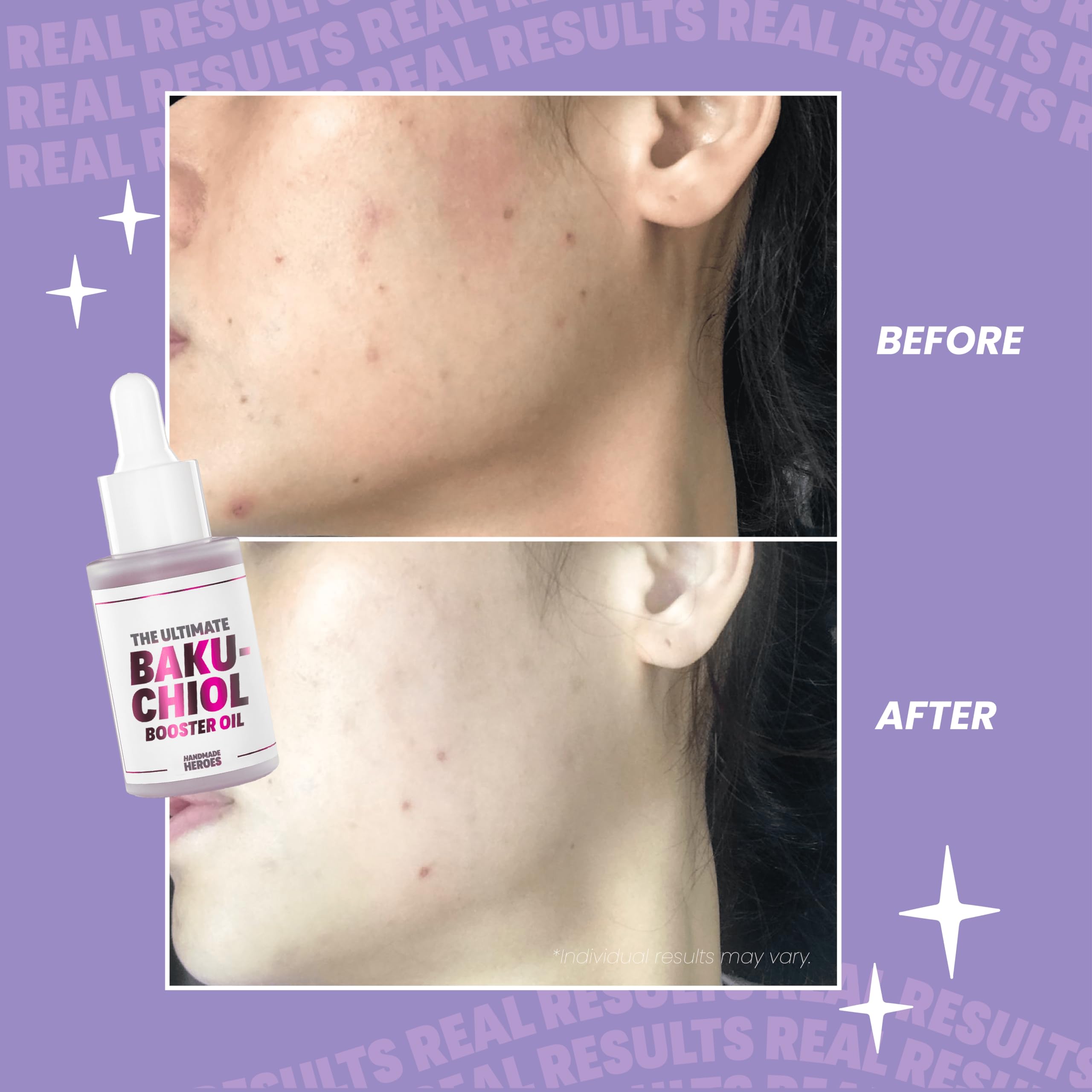 Handmade Heroes 2% Bakuchiol Booster Oil With Sugarcane Squalane, All Natural Retinol Alternative For Radiant And Line Smoothing