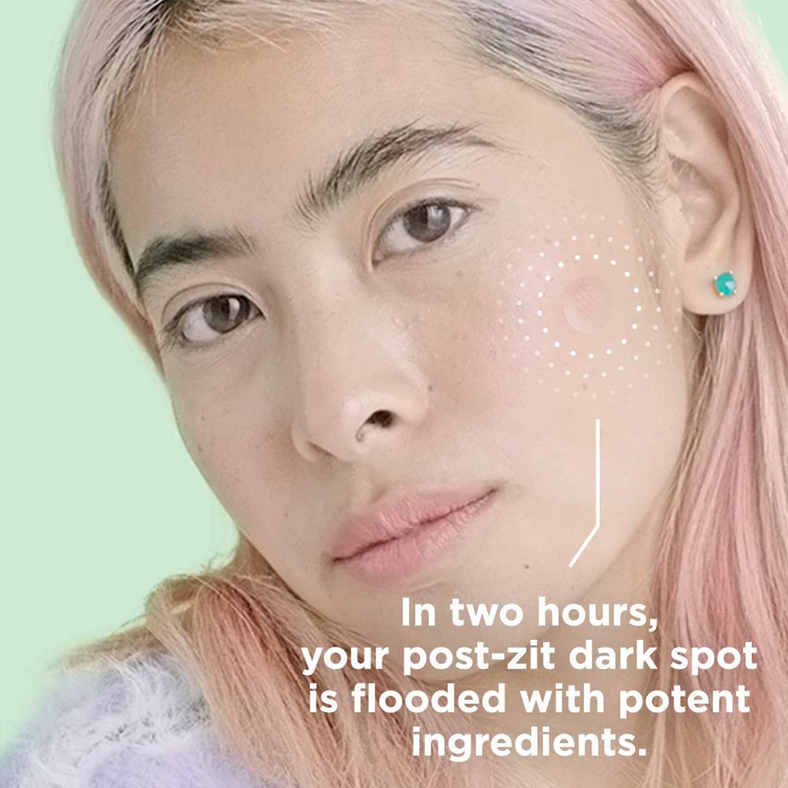 Zitsticka Hyperfade Acne Patches For Face - World'S Most Potent Pimple Patch With Fast-Acting Microdarts - Starts Working Within