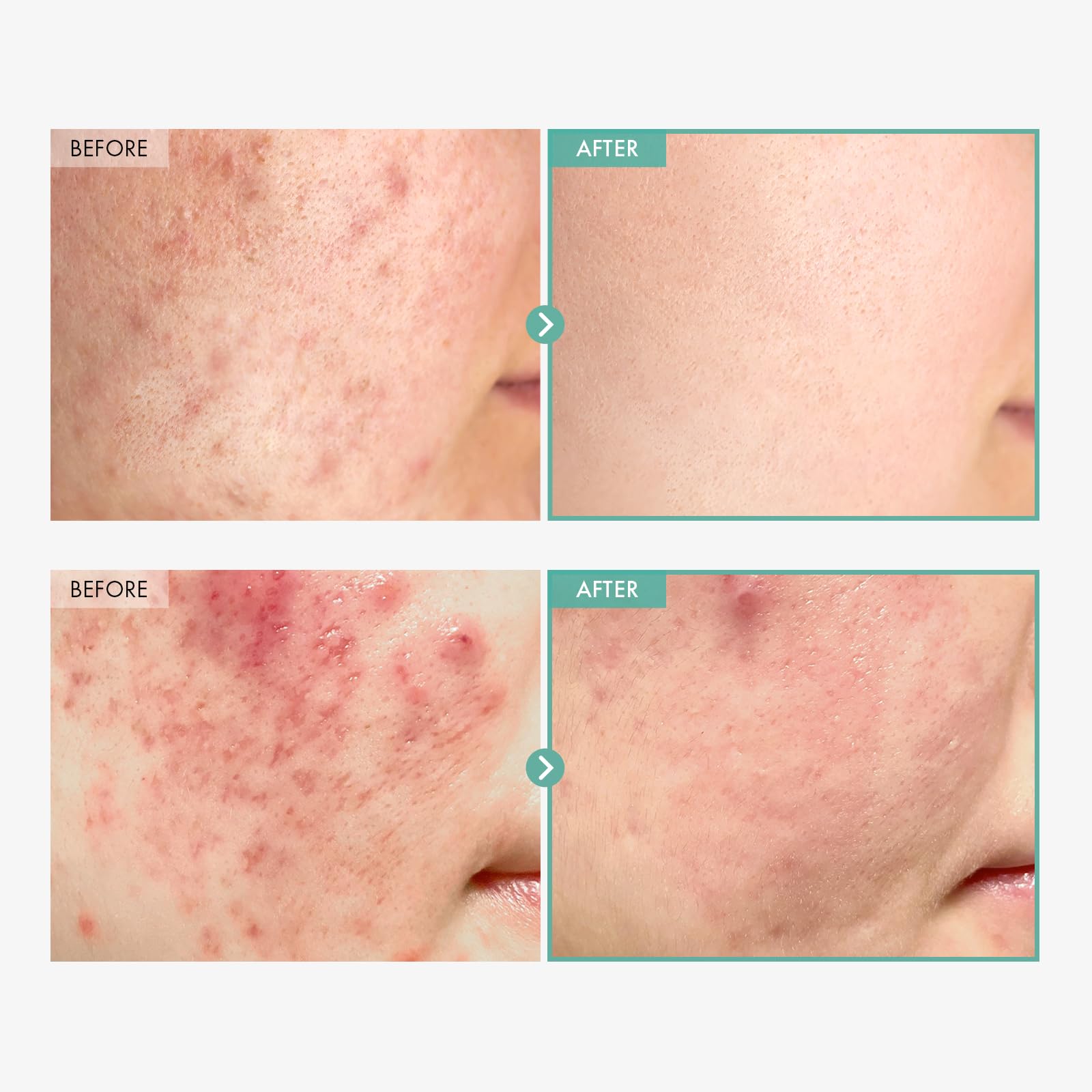 Tosowoong Dexpanthenol Cream, 170,000Ppm B5 Panthenol, Madecassoside, Centella Asiatica For Skin Barrier Repair, Facial Moisturi