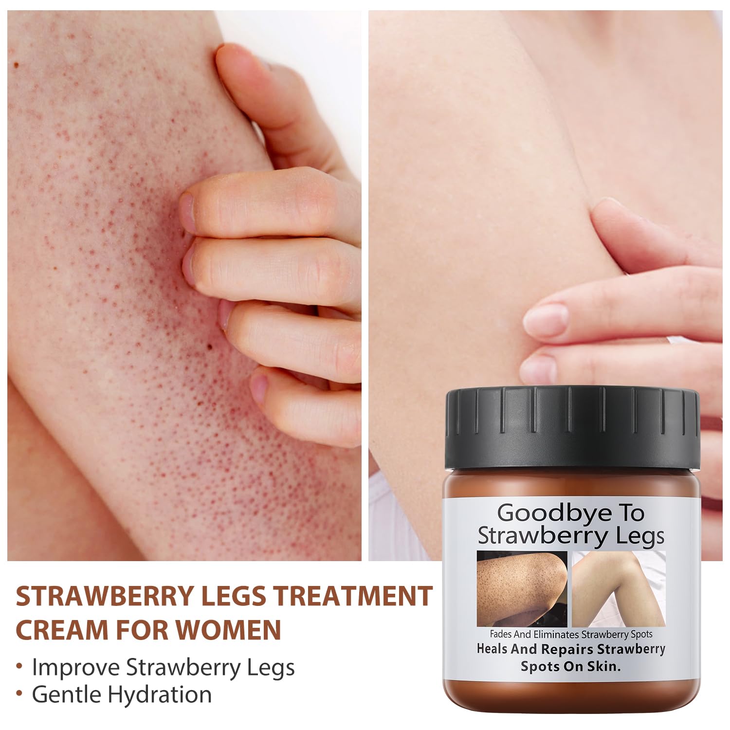 Strawberry Legs Treatment Cream For Women Keratosis Pilaris Lotion Chicken Skin Treatment Moisturizing Strawberry Skin Smooth Ra
