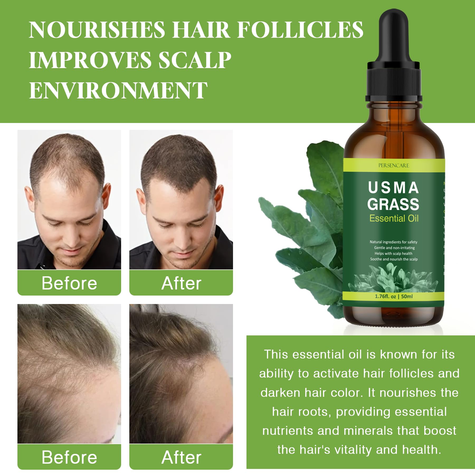 VAEYAE Natural Usma Juice Essential Oil, Usman Grass Polygonum Multiflorum for Hair Growth, Man and Woman Gray Hair Reverse Thic
