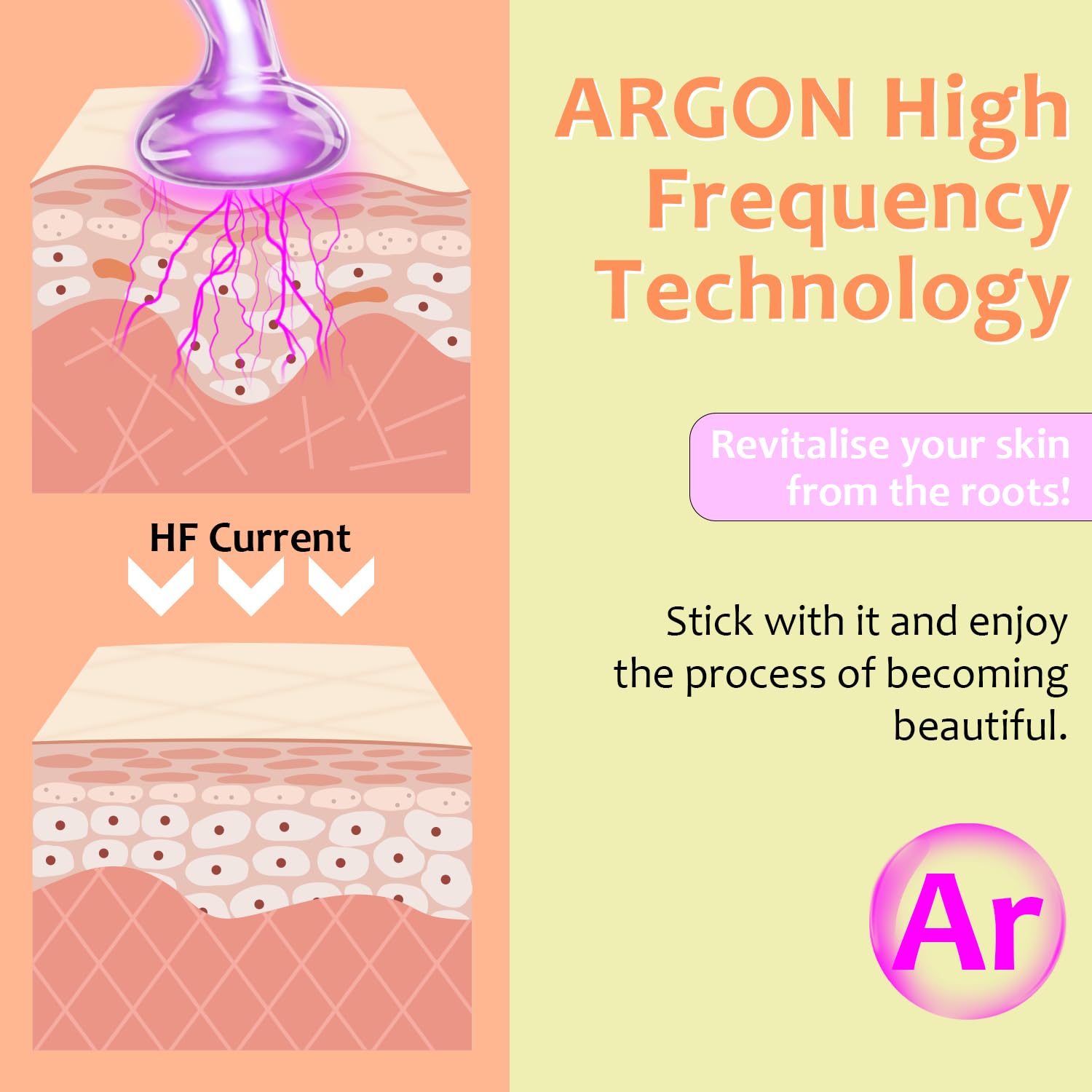 High Frequency Facial Wand - Uaike 4 In 1 Violet Portable Handheld High Frequency Facial Machine - At Home Face Skin Wand Device