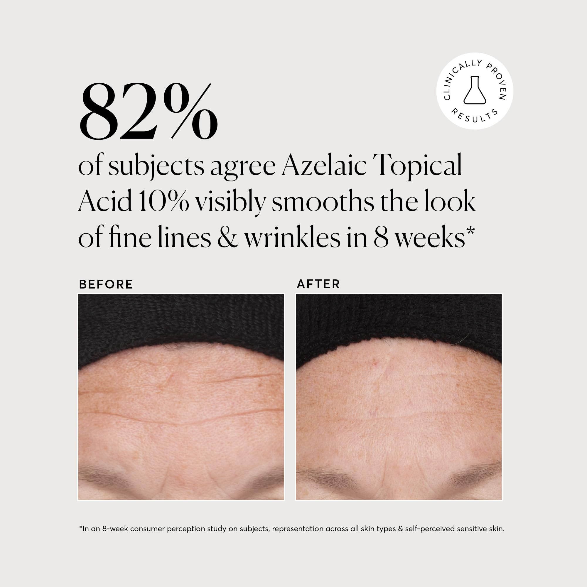 Naturium Azelaic Topical Acid 10%, Brightening Face & Skin Care Treatment With Niacinamide & Vitamin C, 2 Oz