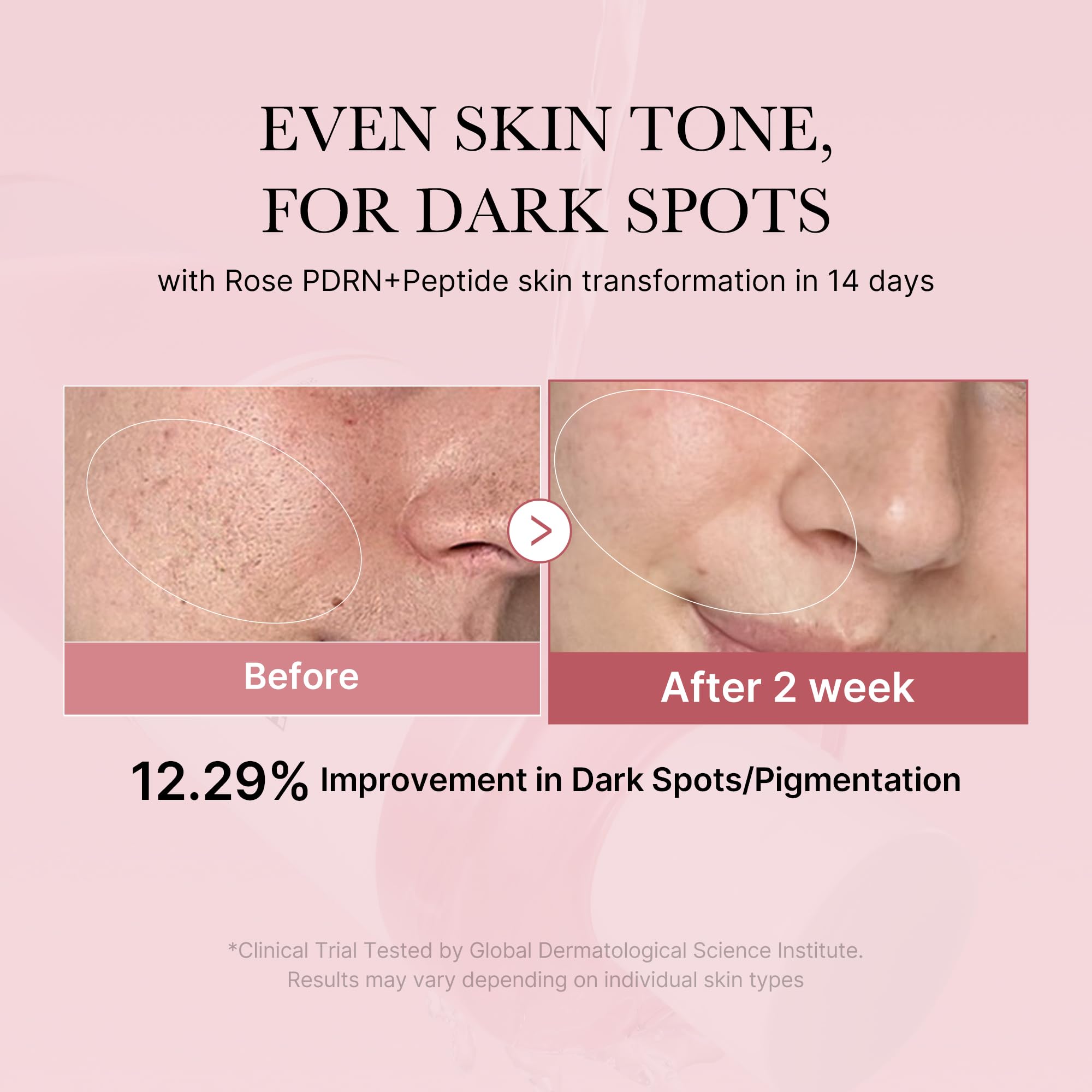 Medicube Pdrn Pink Peptide Toner I Pink Glow Toner For Skin Boosting, Soothing And Calming, Uneven Skin Tone, Rose Pdrn & Peptid
