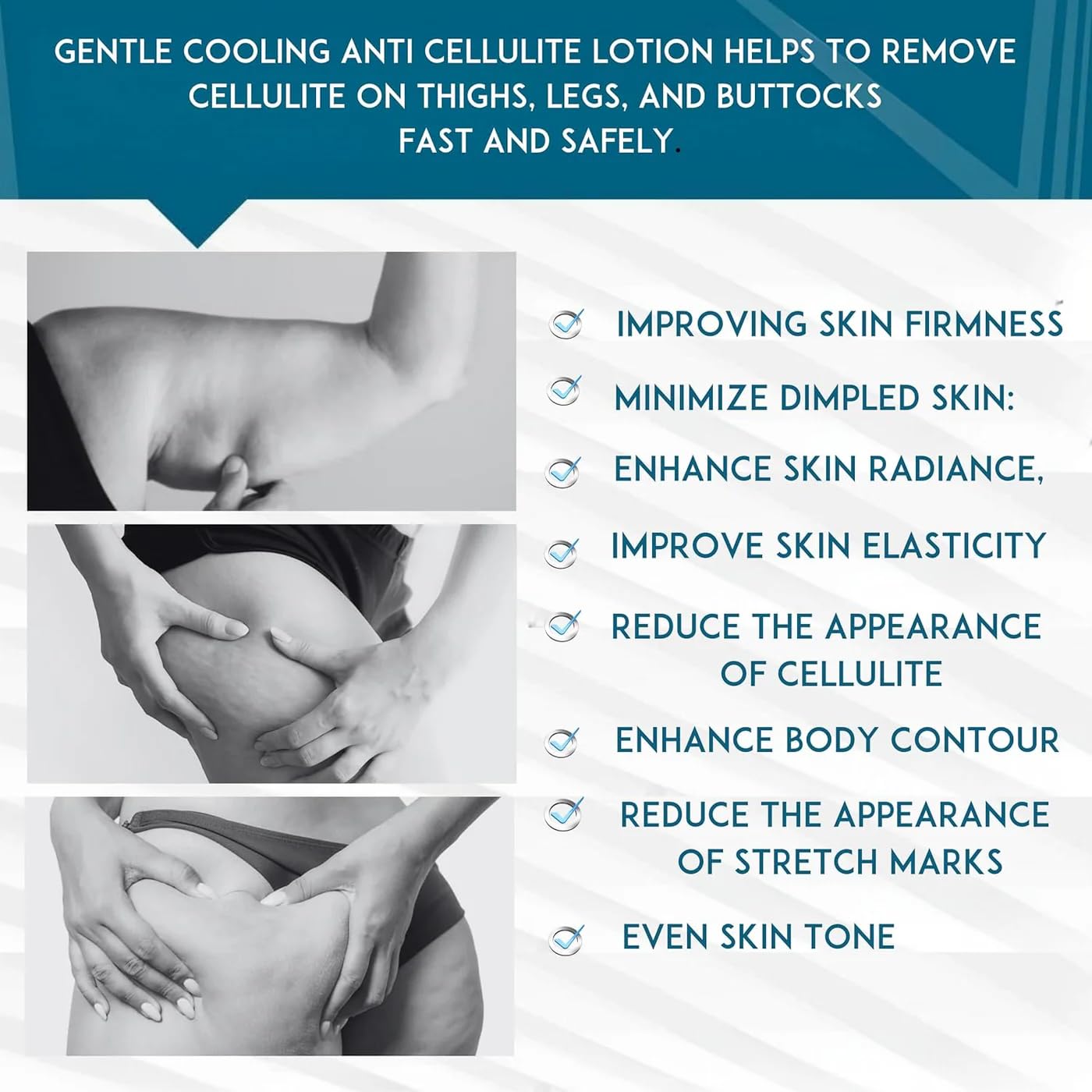 Anacis Cellulite Cream Treatment Reaffirming Complex Gel Diminishes The Appearance of Uneven Skin Tone and Rejuvenate 5.07 Oz