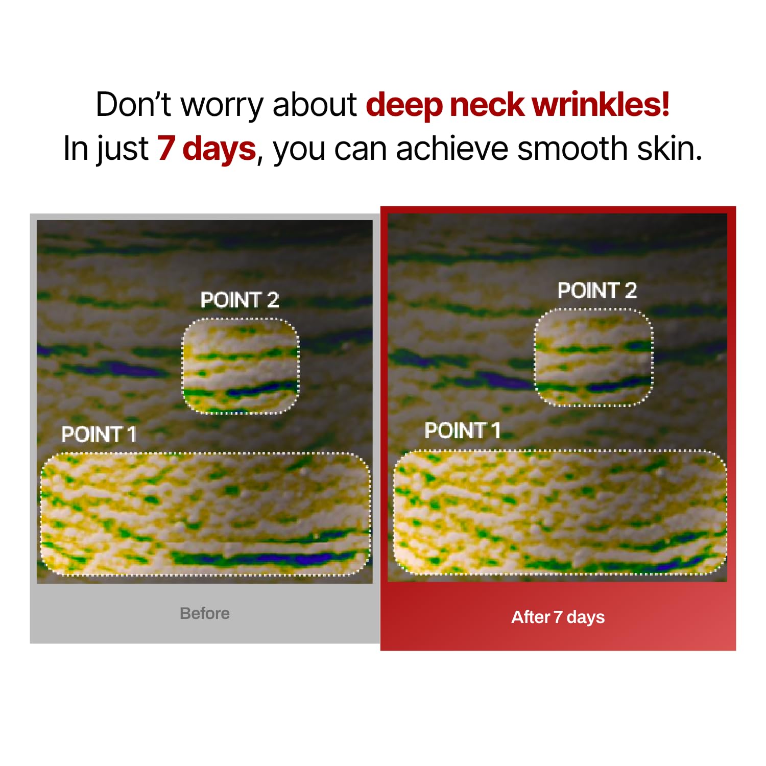 Meditherapy Wrinkle Fit Neck Masks 7Ea + Face Roller, Neck Wrinkle Collagen Patches, Facial Massage Tool, V Line Lifting, Tighte